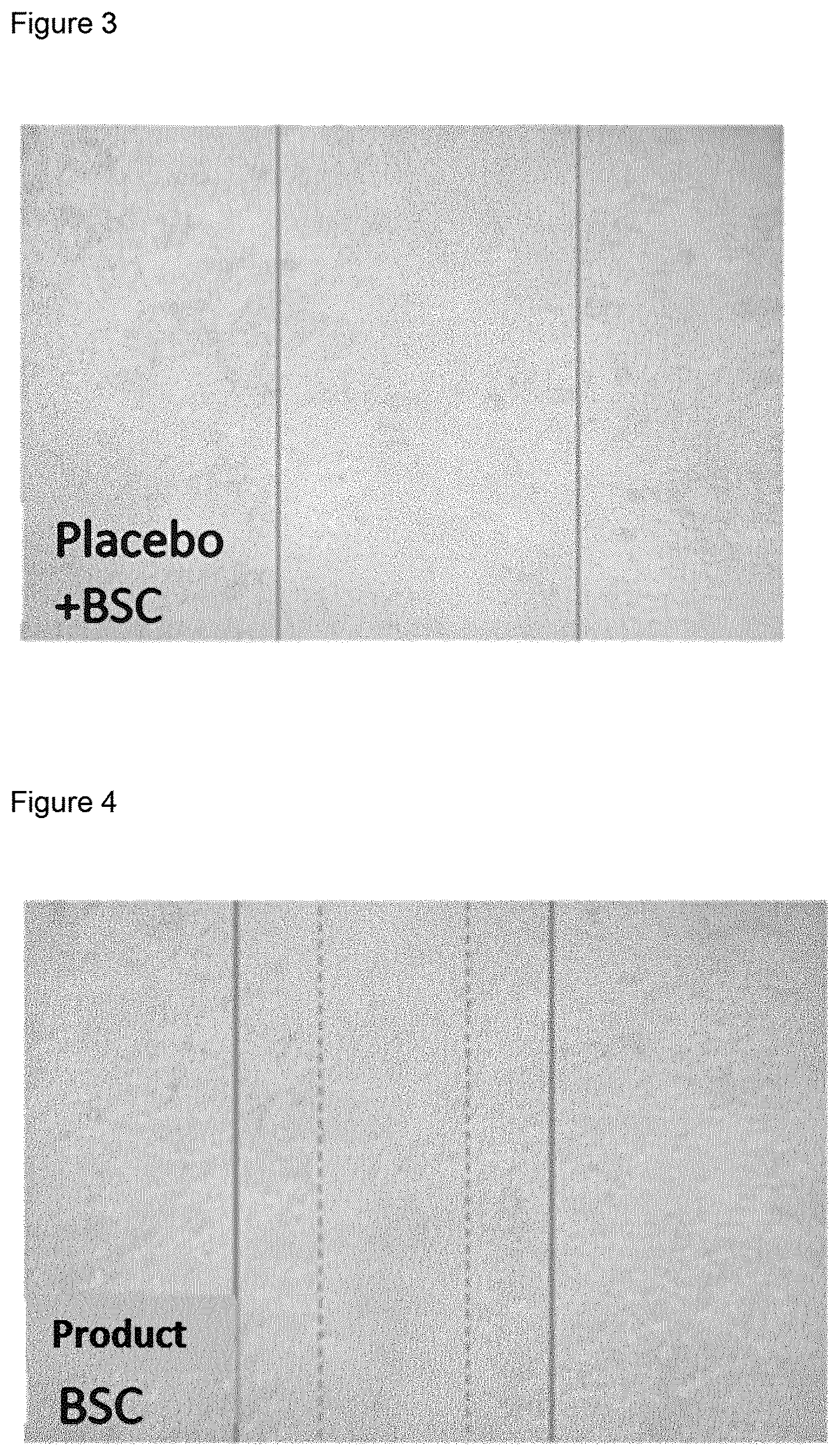 Patent US11779594 Figure 2 – Compositions for the treatment of epithelial lesions