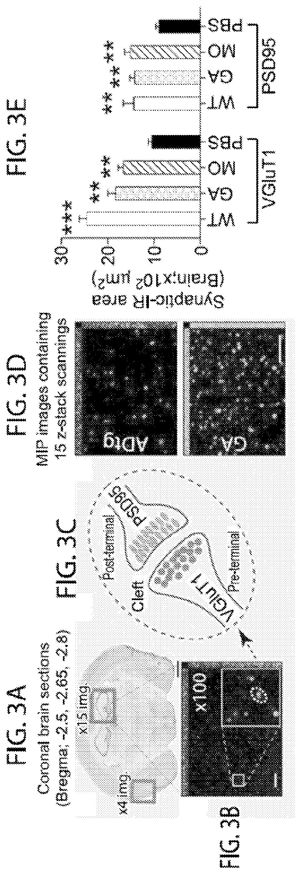 Patent US11779600 Figure 3 – Methods of treating or preventing alzheimer's disease and associated conditions