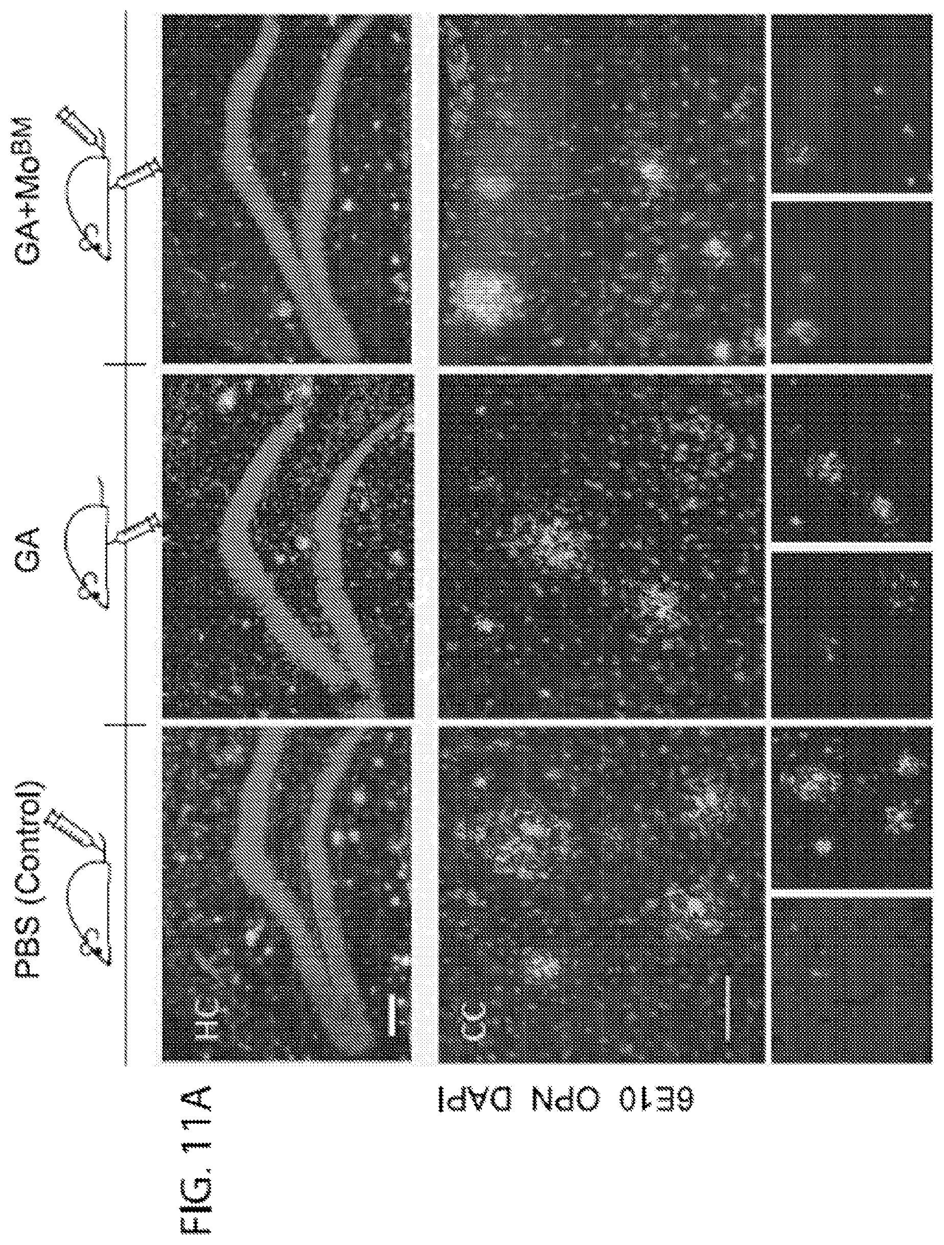 Patent US11779600 Figure 10 – Methods of treating or preventing alzheimer's disease and associated conditions