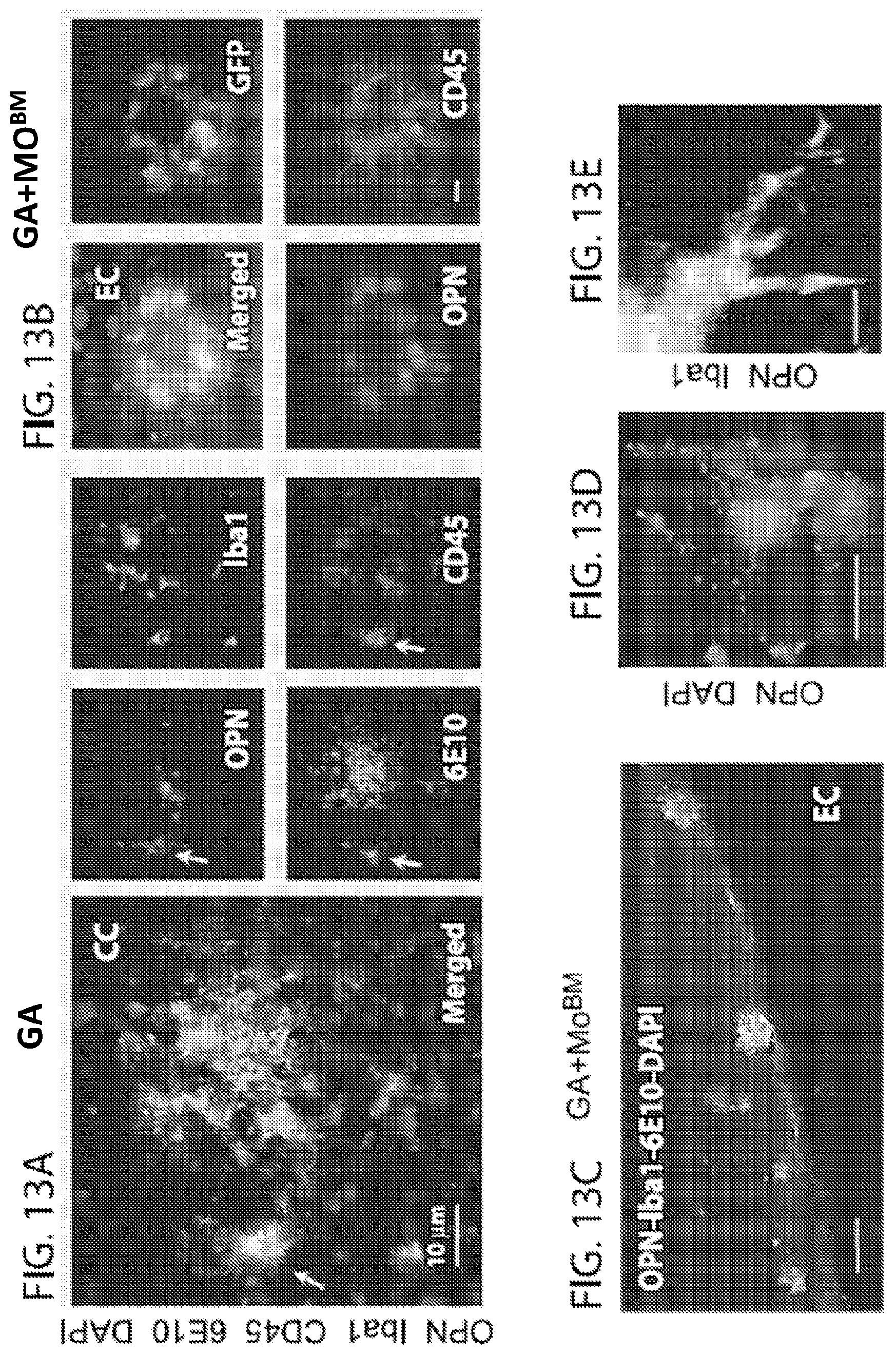 Patent US11779600 Figure 15 – Methods of treating or preventing alzheimer's disease and associated conditions