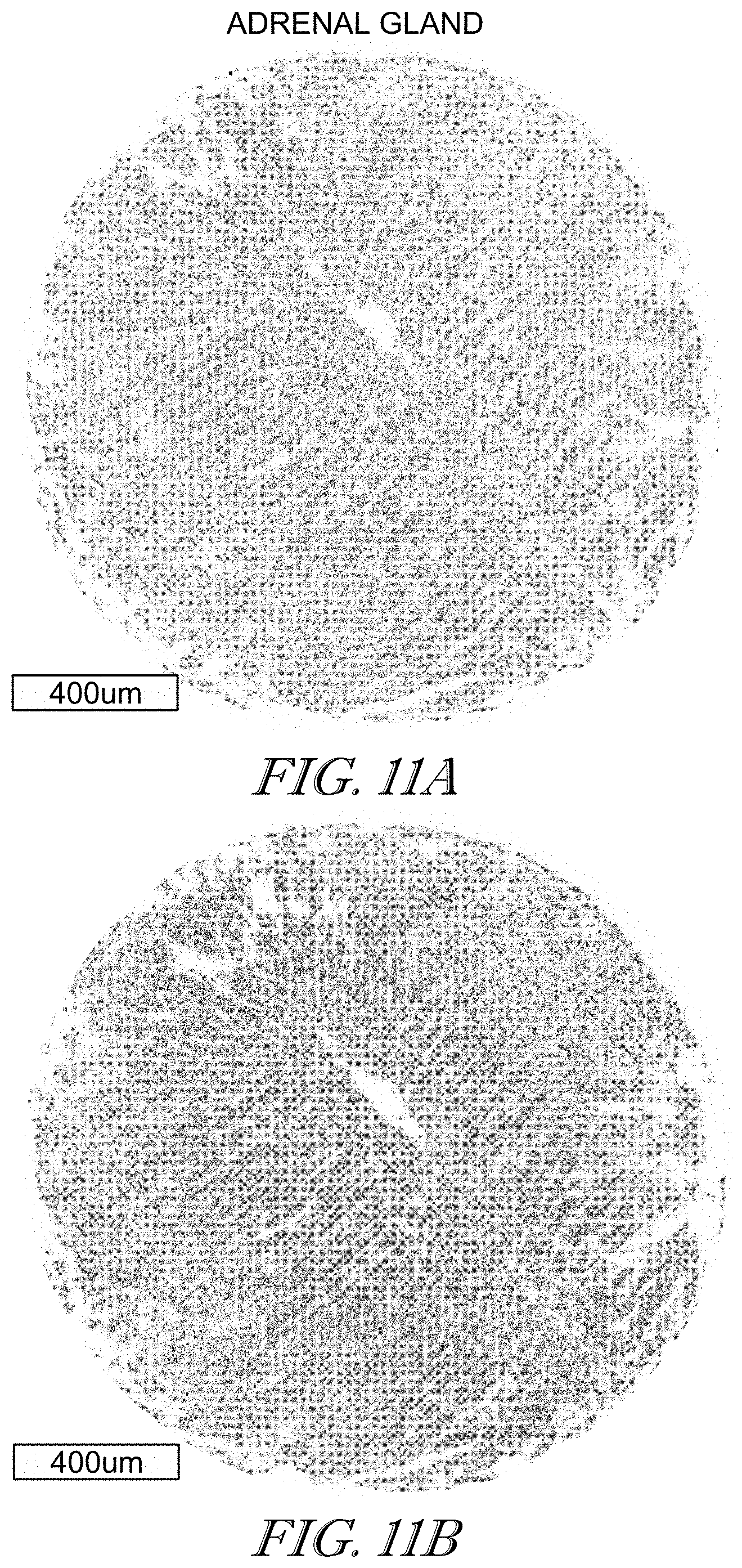 Patent US11779602 Figure 11 – Methods of use for CAR T cells