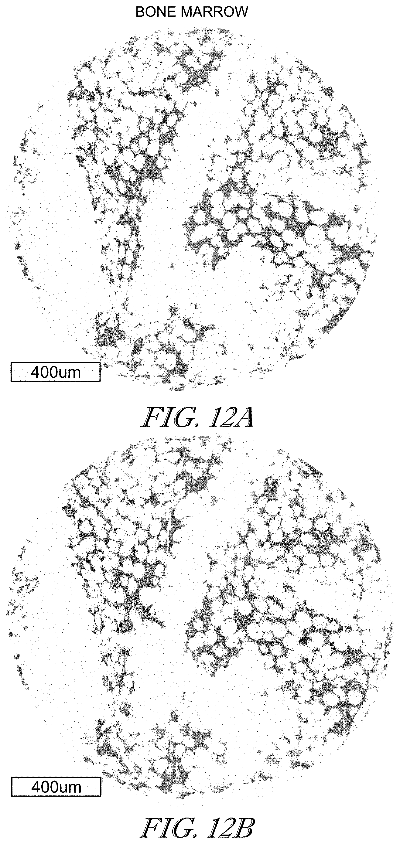 Patent US11779602 Figure 12 – Methods of use for CAR T cells