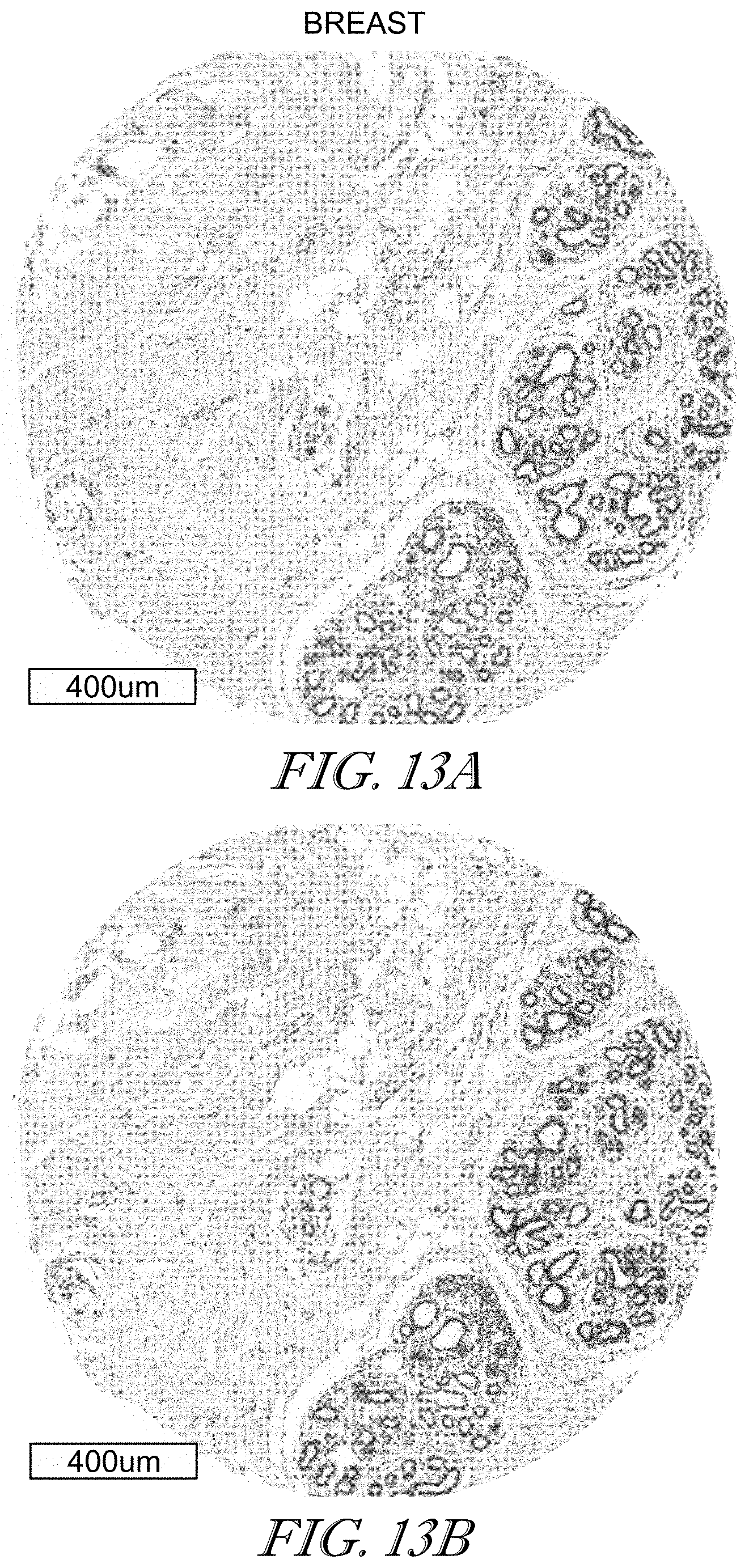 Patent US11779602 Figure 13 – Methods of use for CAR T cells