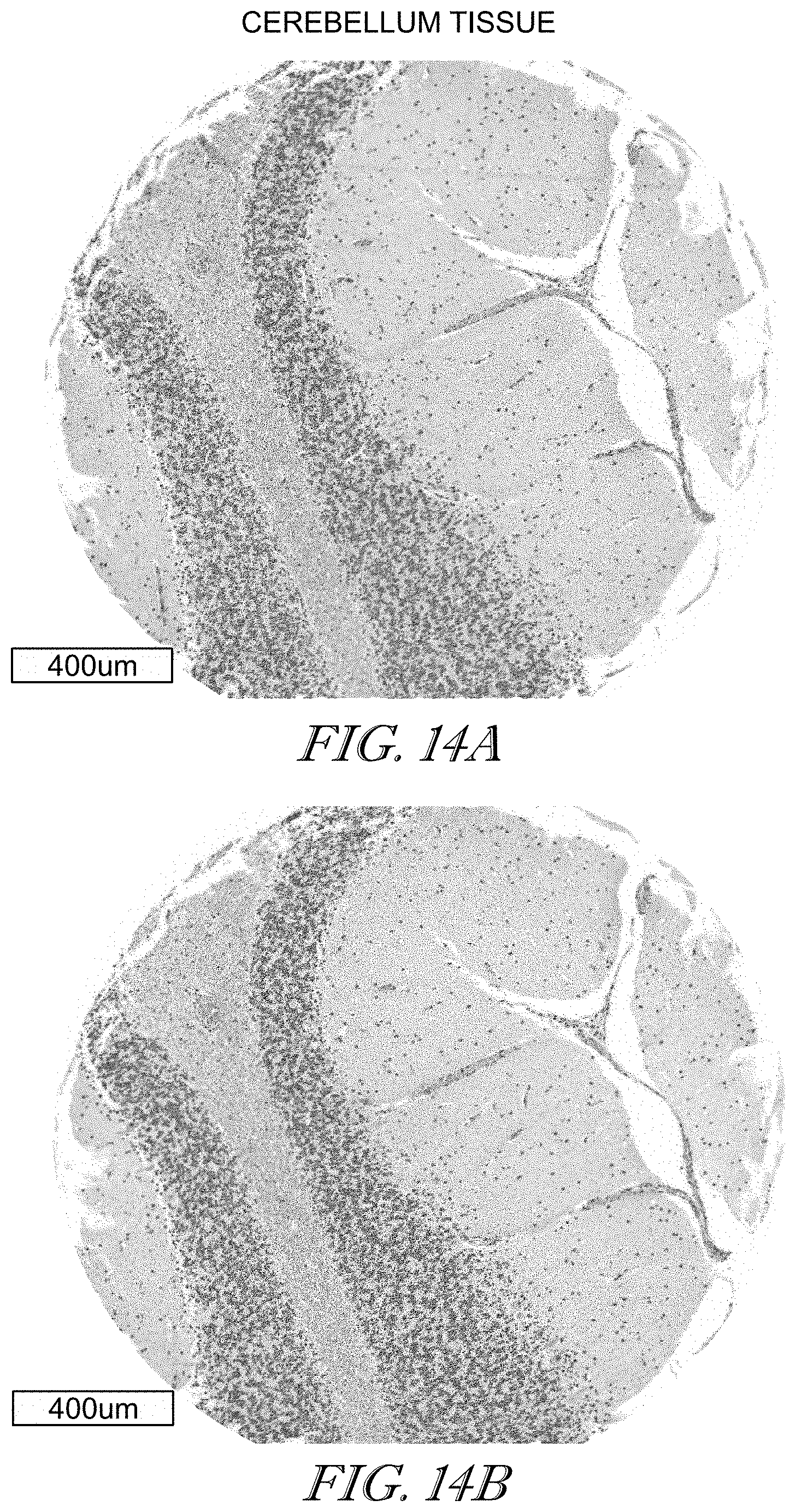 Patent US11779602 Figure 14 – Methods of use for CAR T cells