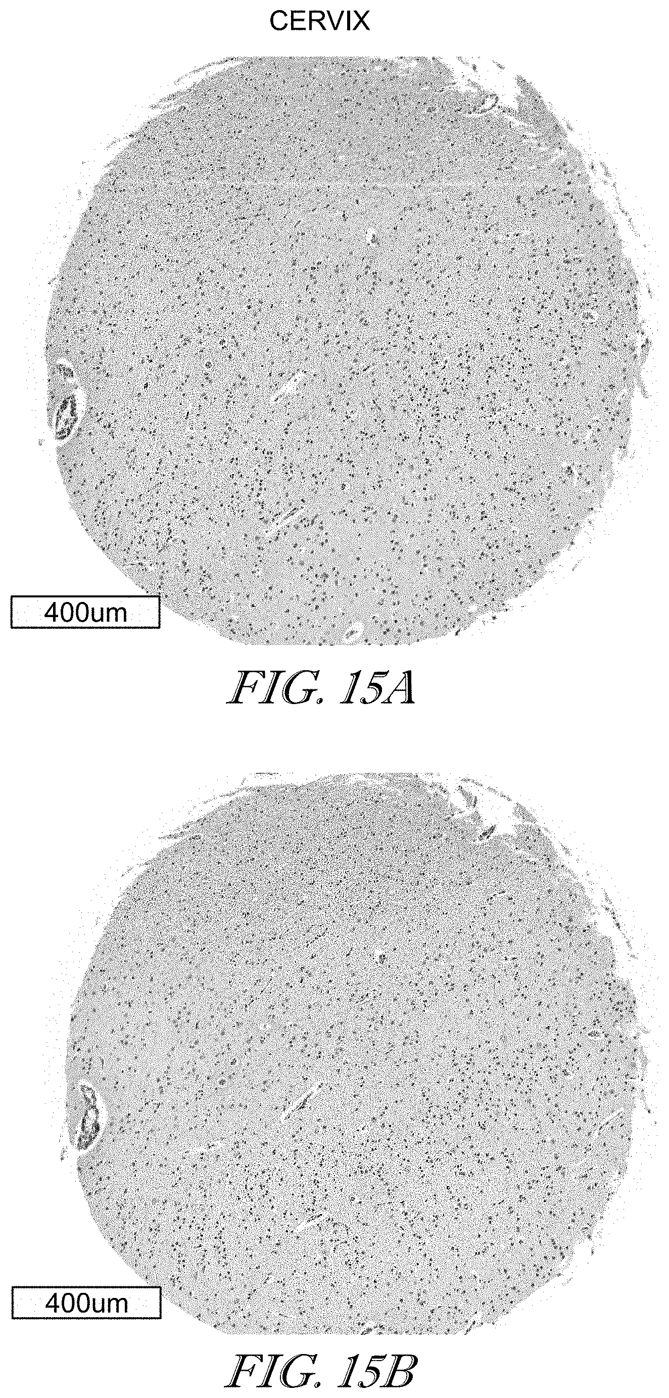 Patent US11779602 Figure 15 – Methods of use for CAR T cells