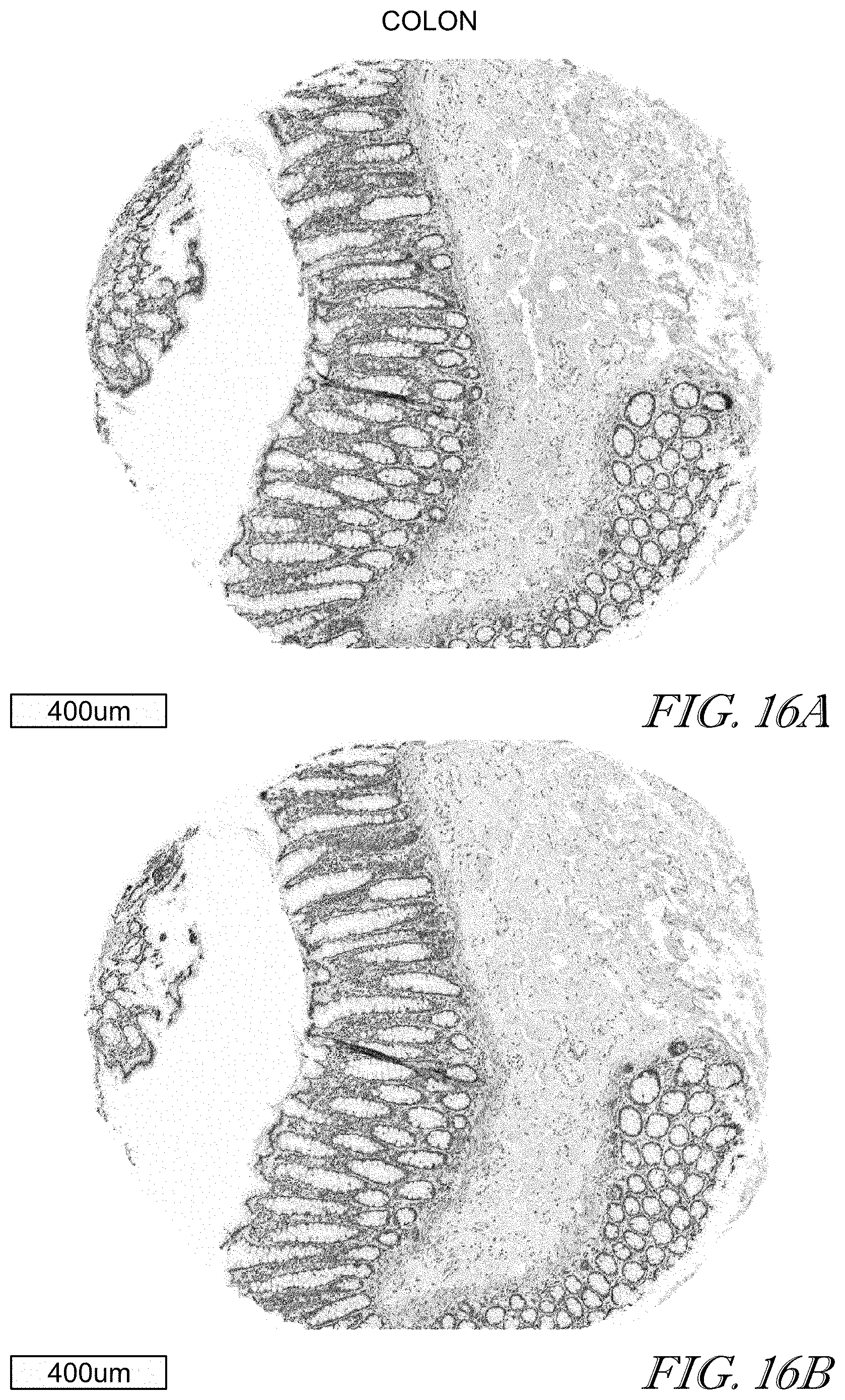 Patent US11779602 Figure 16 – Methods of use for CAR T cells
