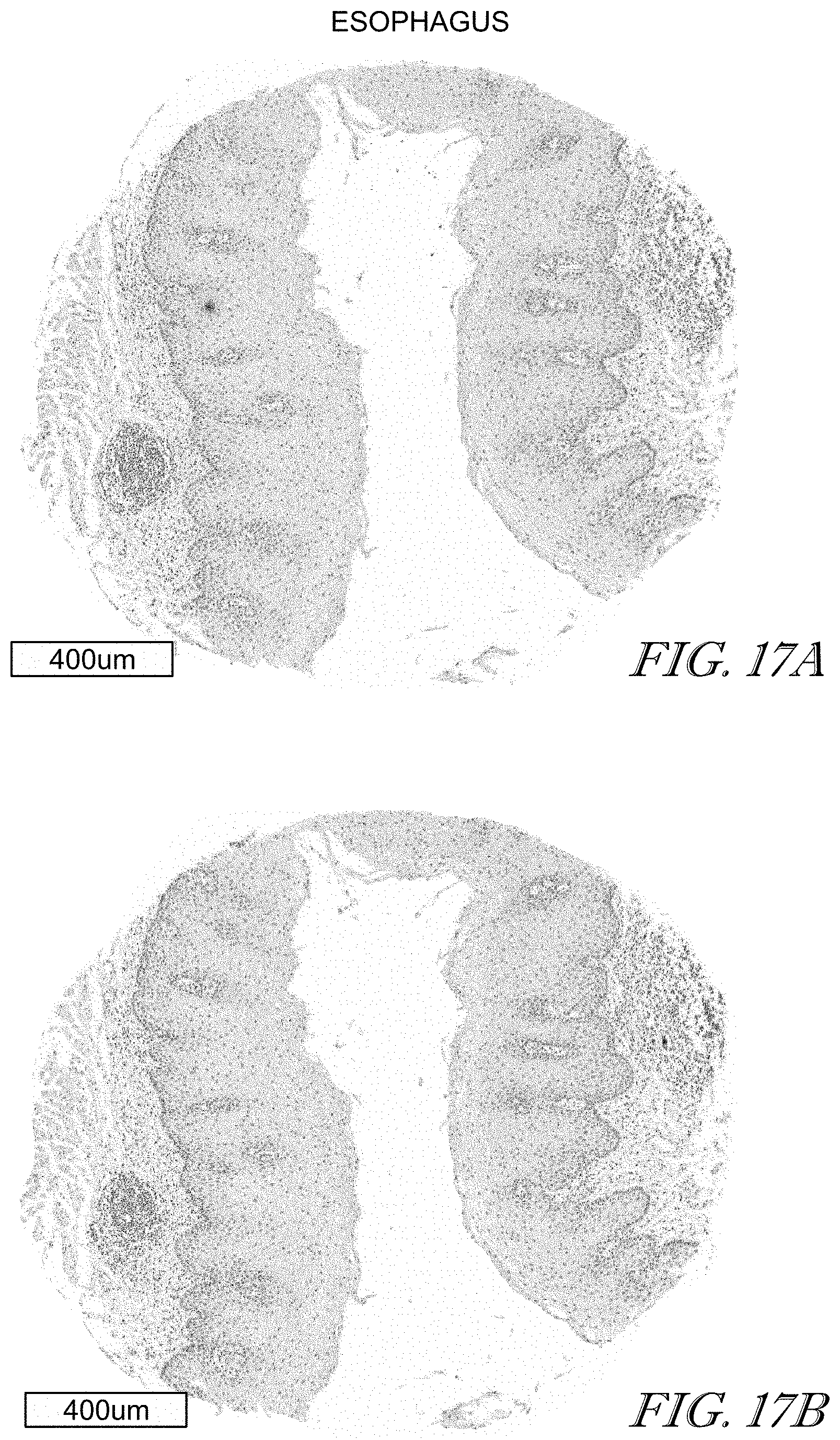 Patent US11779602 Figure 17 – Methods of use for CAR T cells