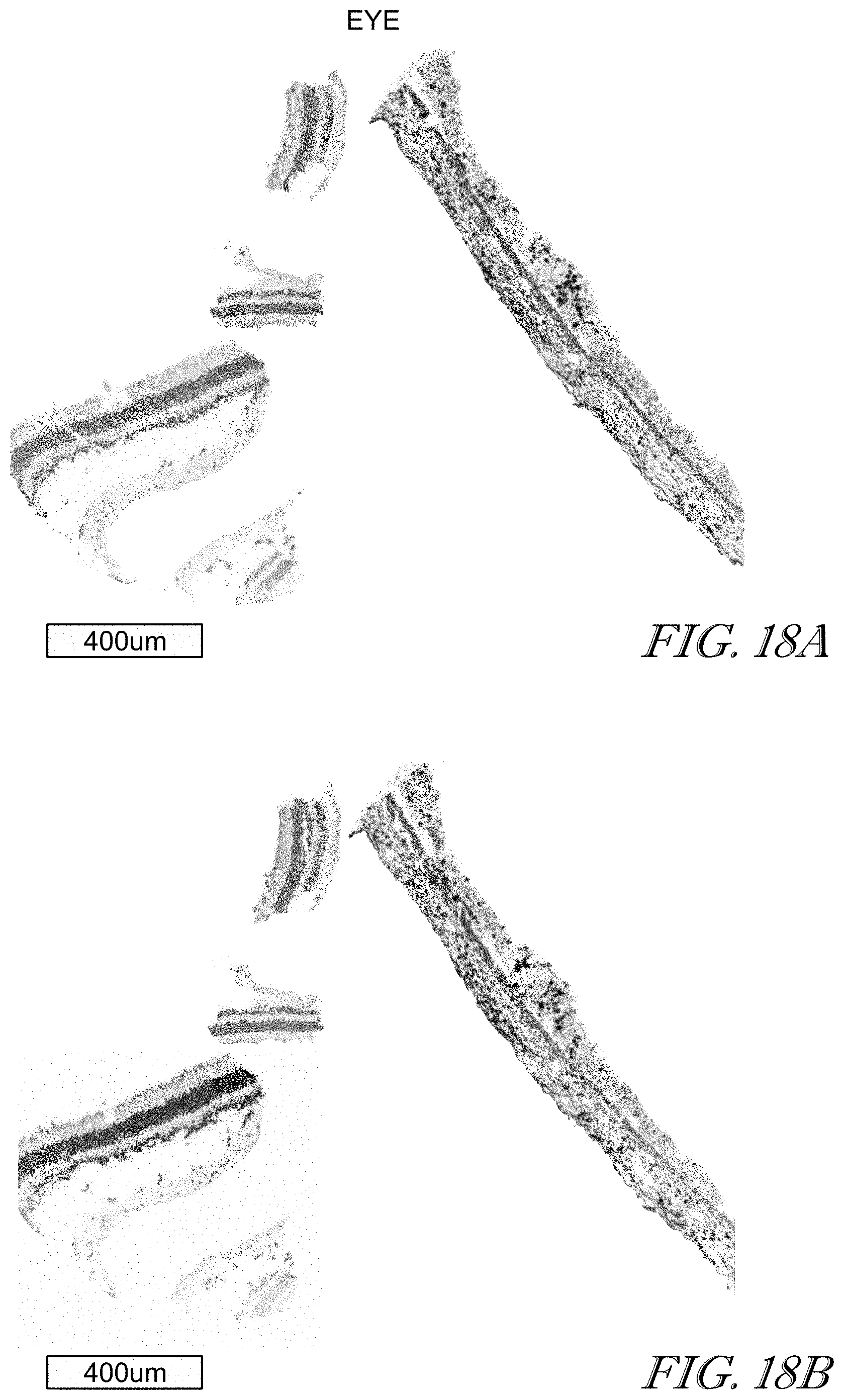Patent US11779602 Figure 18 – Methods of use for CAR T cells