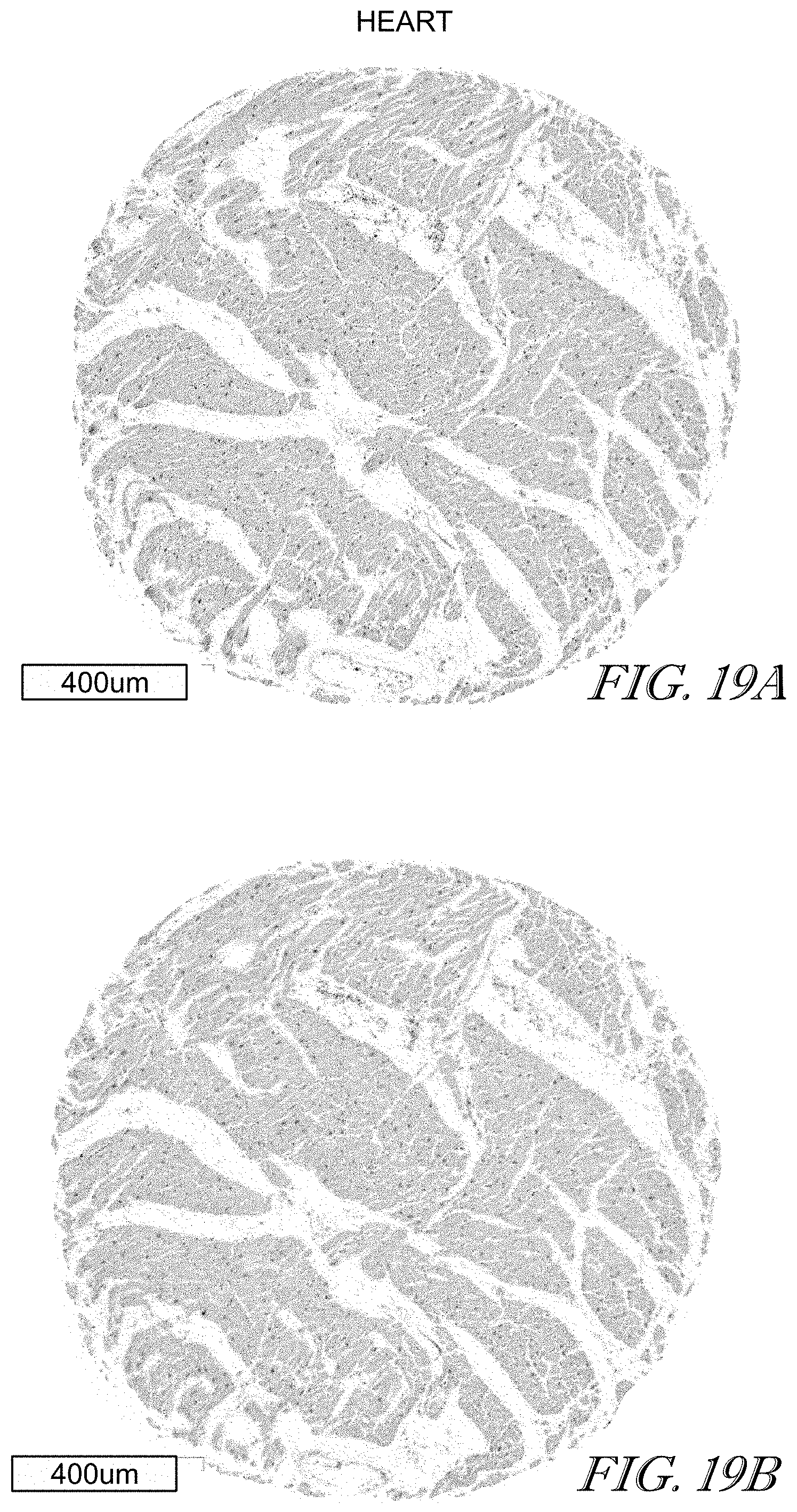 Patent US11779602 Figure 19 – Methods of use for CAR T cells