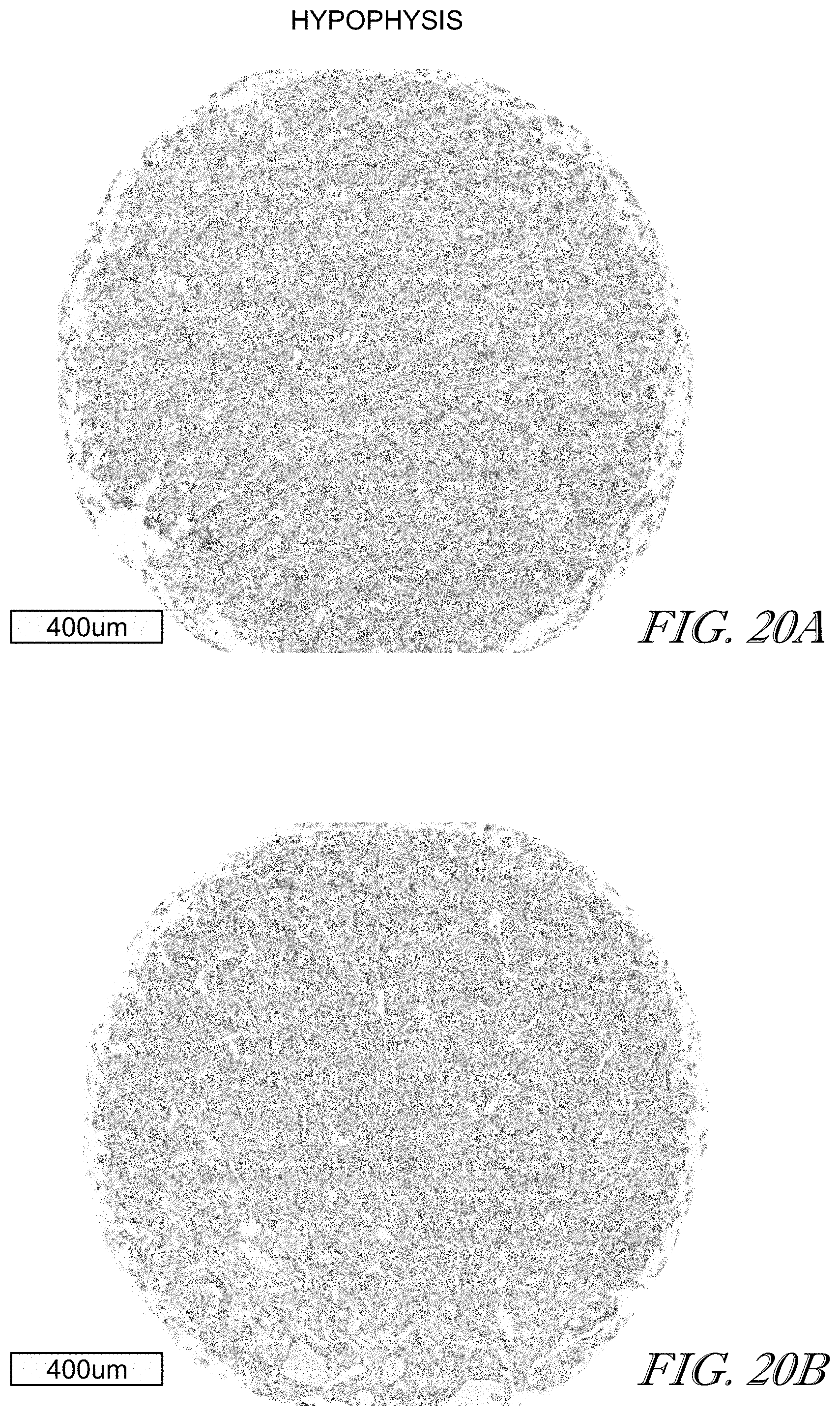 Patent US11779602 Figure 20 – Methods of use for CAR T cells