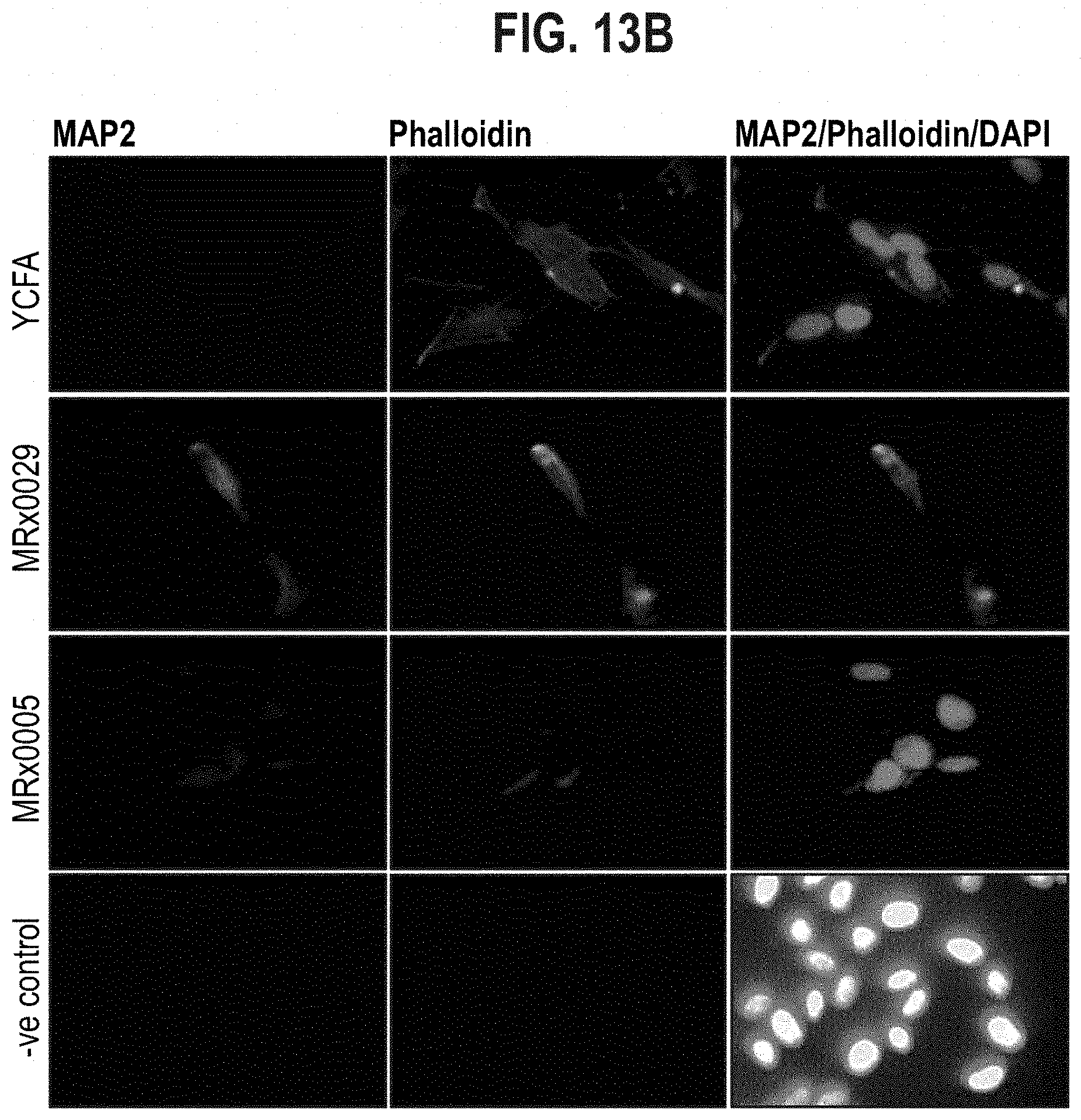 Patent US11779613 Figure 11 – Compositions comprising a bacterial strain of the genus Megasphera and uses thereof