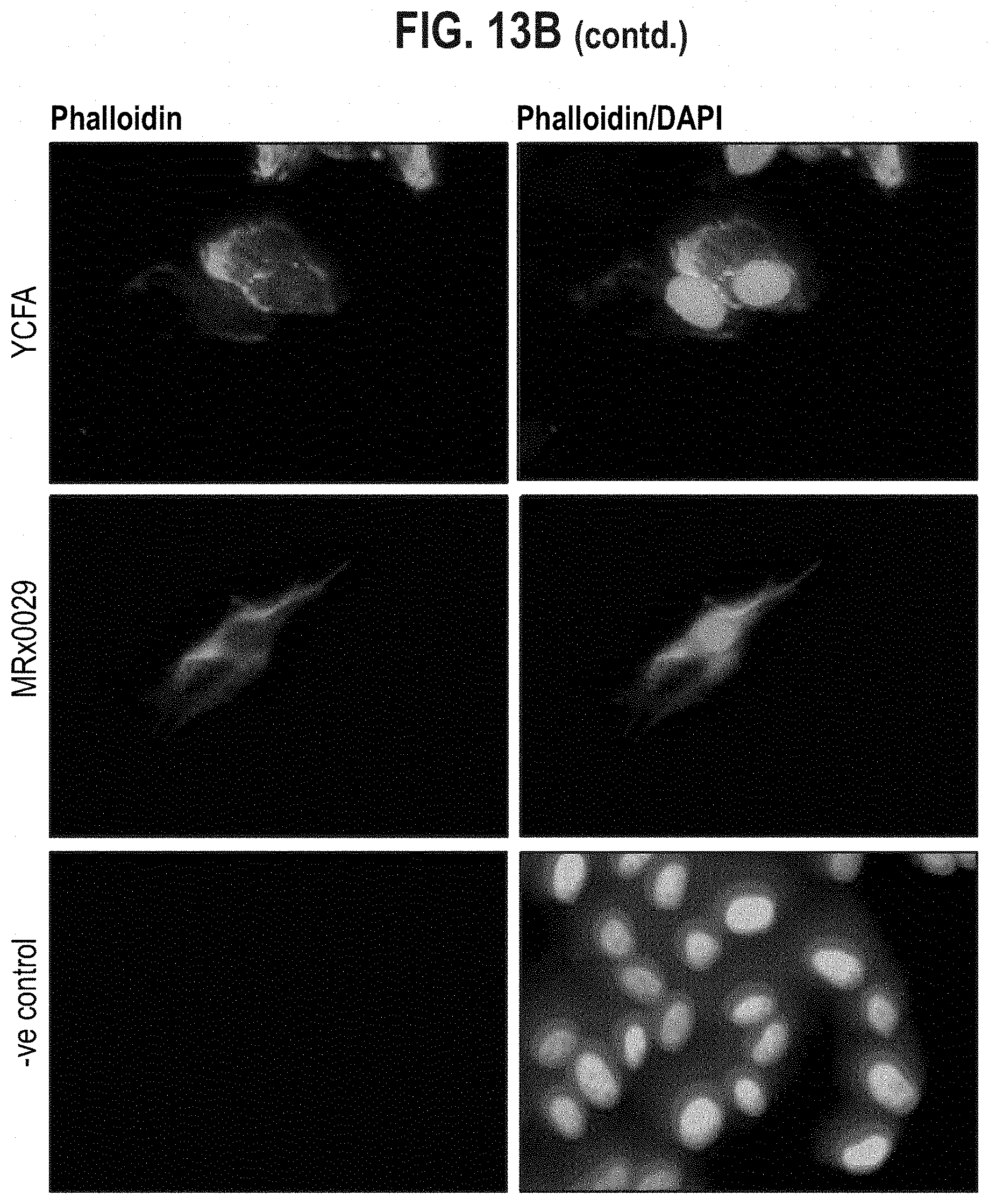 Patent US11779613 Figure 12 – Compositions comprising a bacterial strain of the genus Megasphera and uses thereof