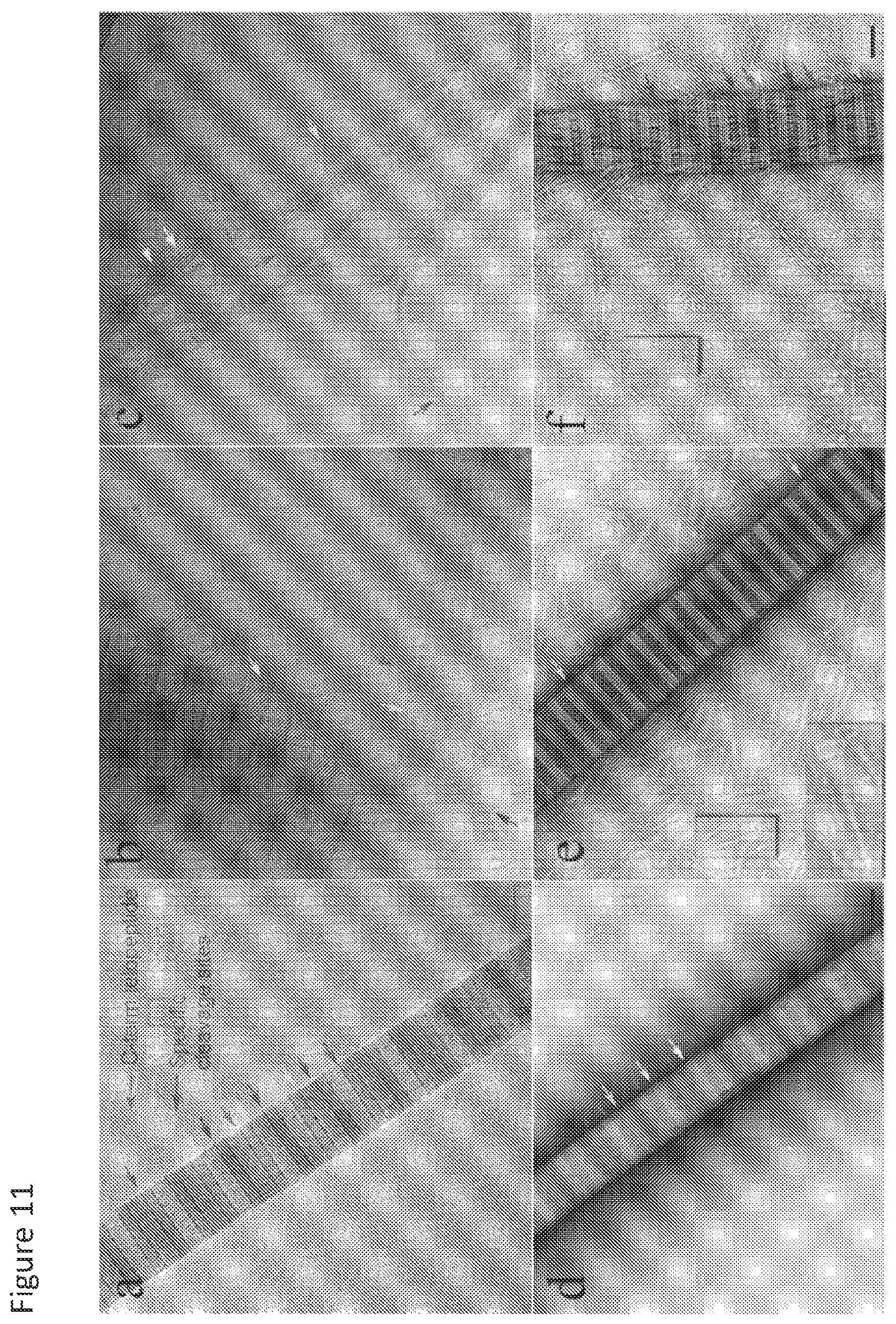Patent US11779636 Figure 11 – Compositions for remodeling extracellular matrix and methods of use thereof
