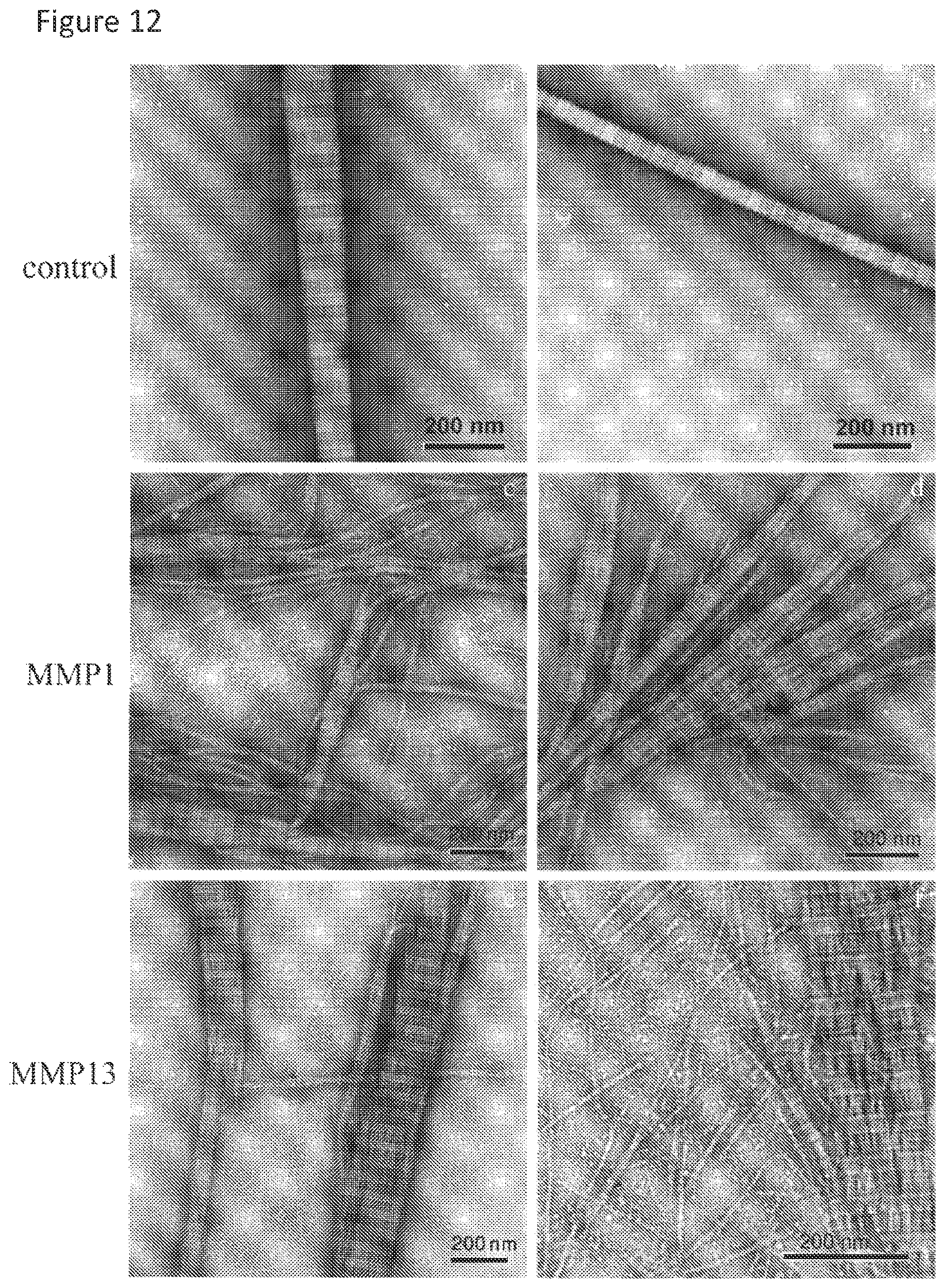 Patent US11779636 Figure 12 – Compositions for remodeling extracellular matrix and methods of use thereof