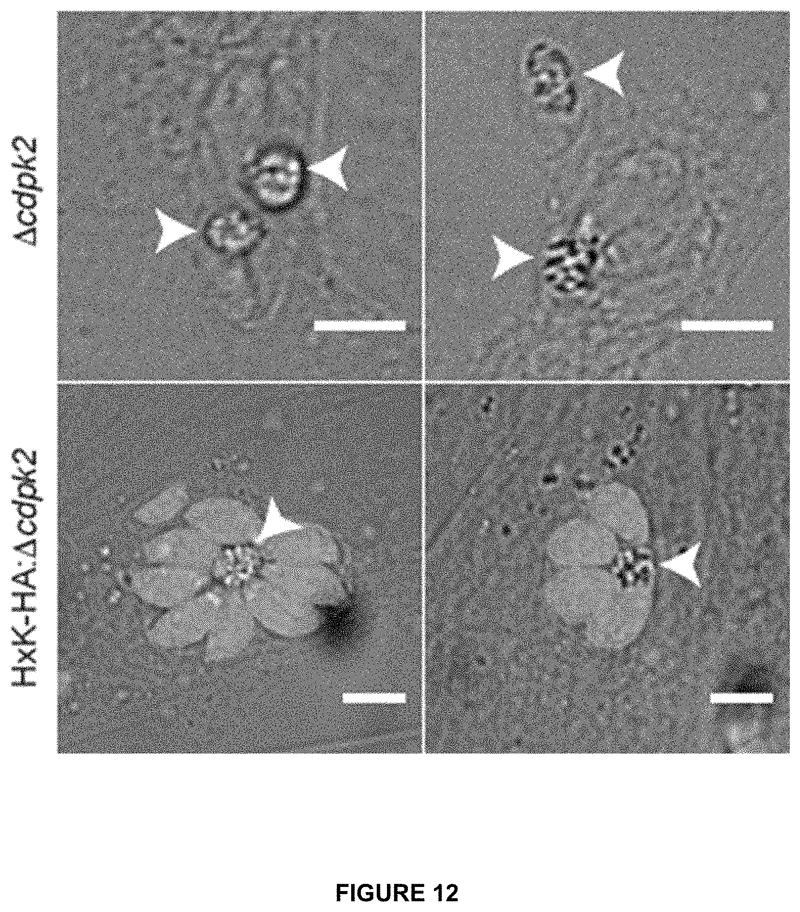Patent US11779639 Figure 14 – Parasite vaccine