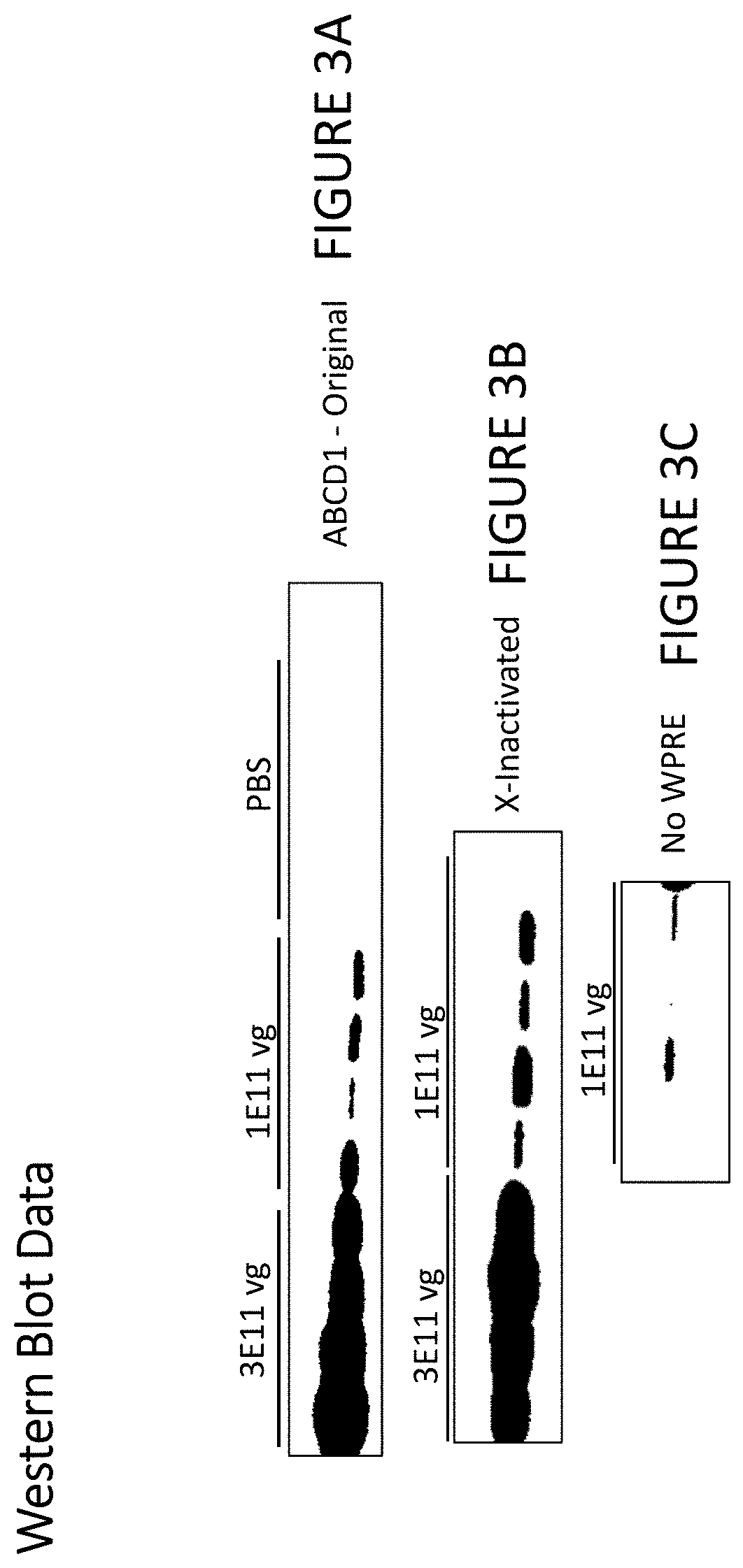 Patent US11779655 Figure 3 – AAV-ABCD1 constructs and use for treatment or prevention of adrenoleukodystrophy (ALD) and/or adrenomyeloneuropathy (AMN)
