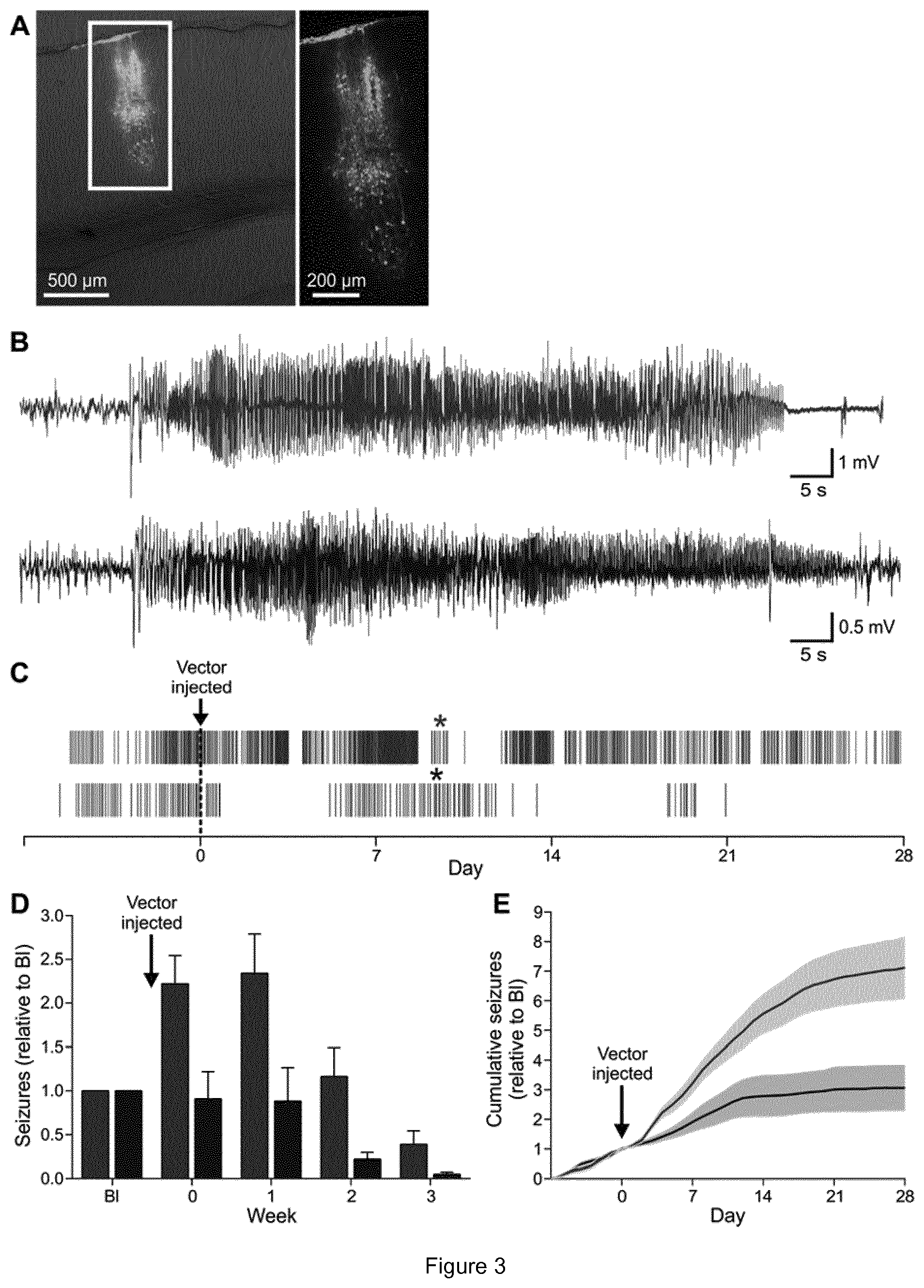 Patent US11779658 Figure 3 – Expression vectors comprising engineered genes