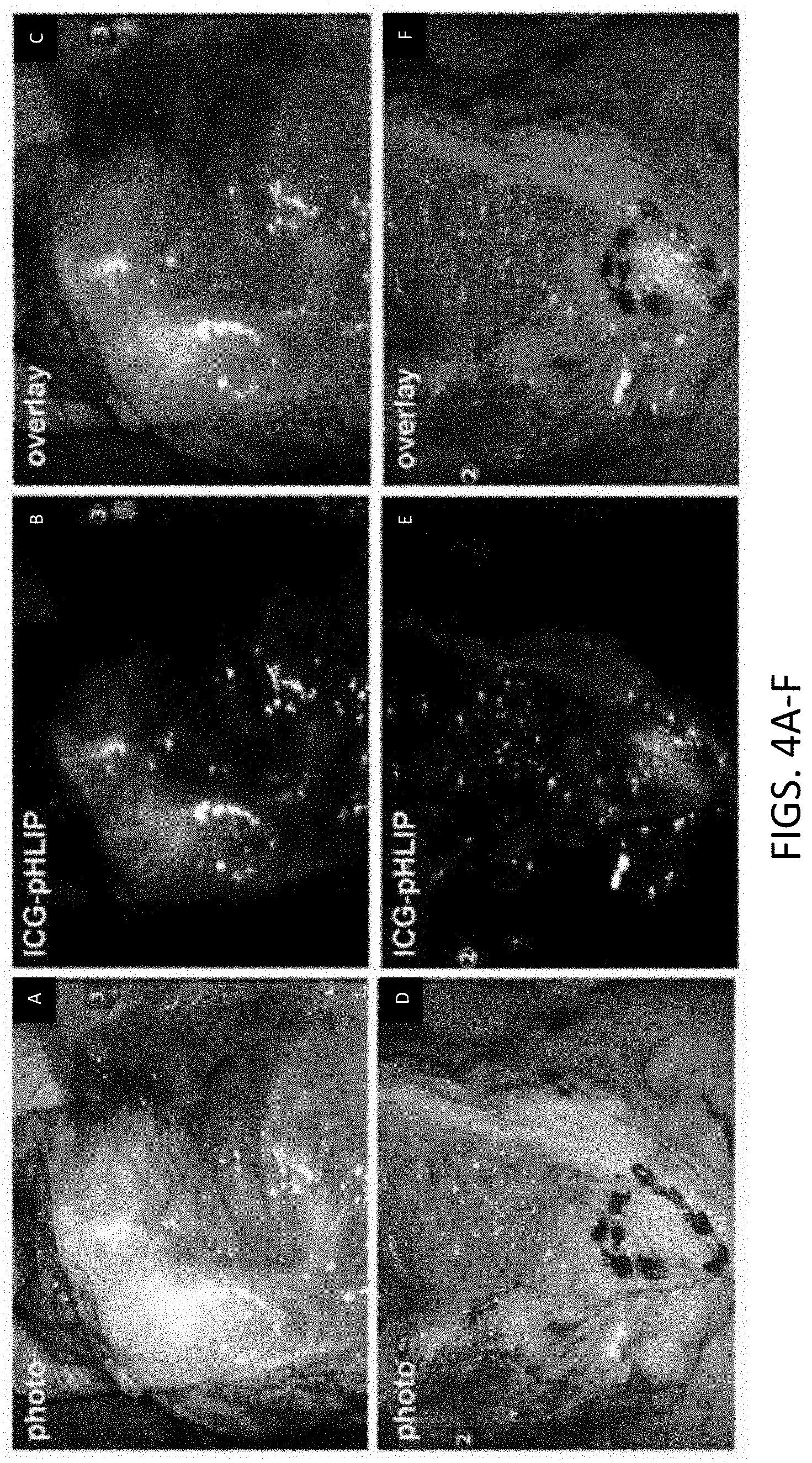 Patent US11779662 Figure 4 – Fluorescent compound comprising a fluorophore conjugated to a pH-triggered polypeptide