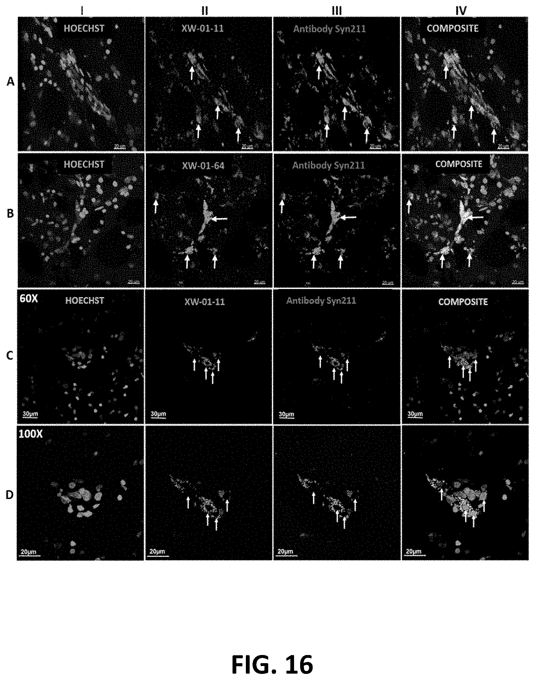 Patent US11779664 Figure 16 – Targeted contrast agents for MRI of alpha-synuclein deposition