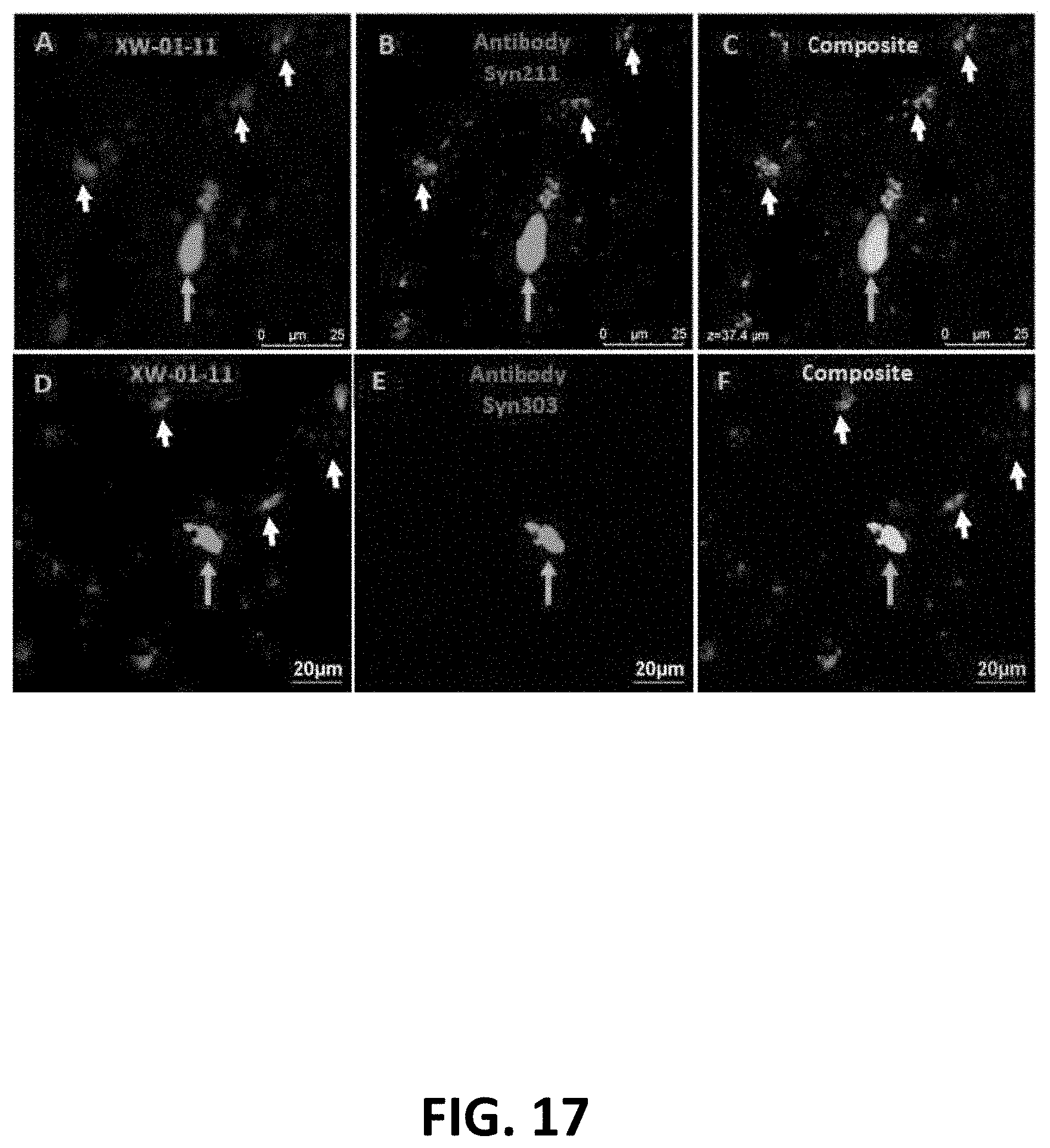 Patent US11779664 Figure 17 – Targeted contrast agents for MRI of alpha-synuclein deposition