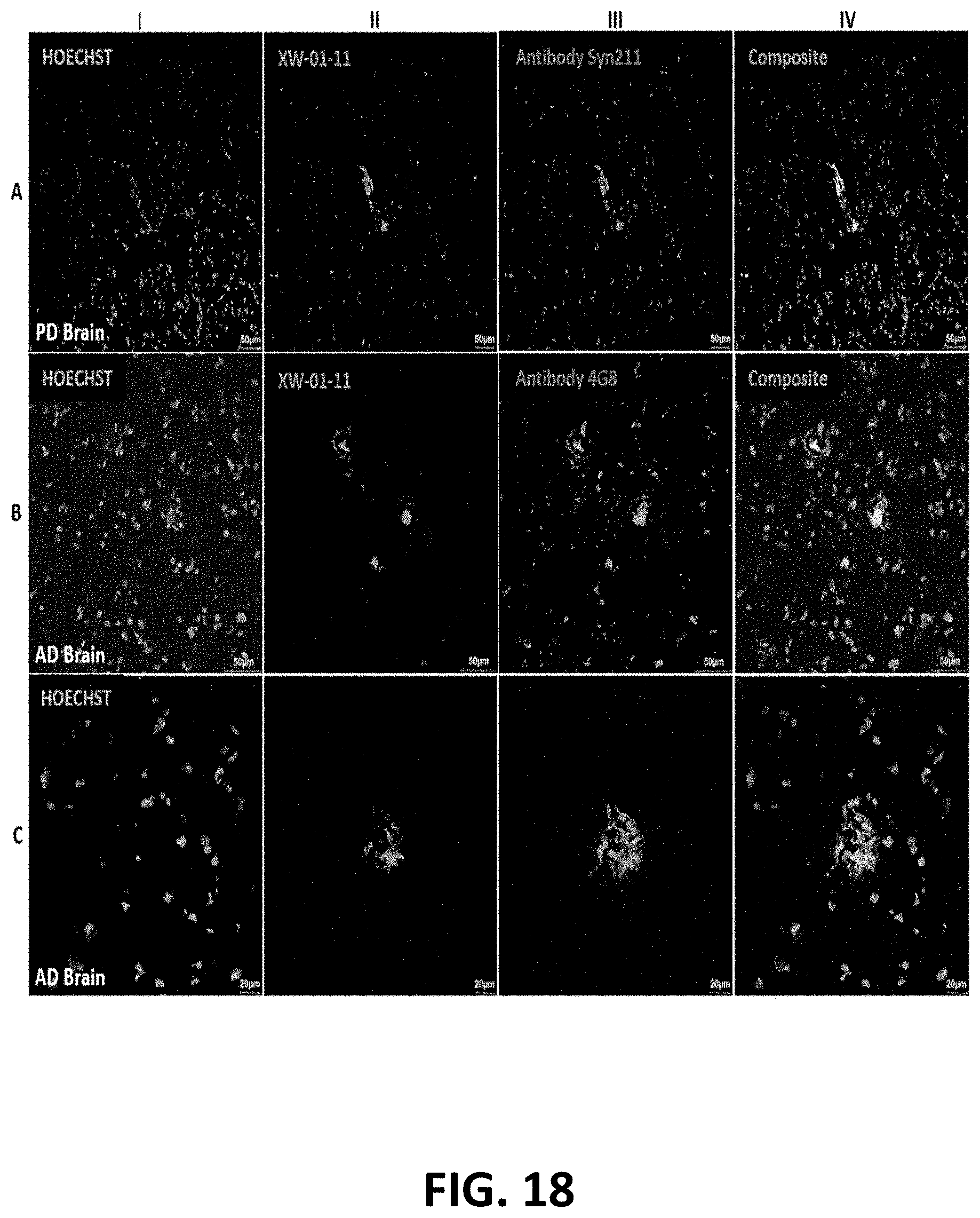 Patent US11779664 Figure 18 – Targeted contrast agents for MRI of alpha-synuclein deposition
