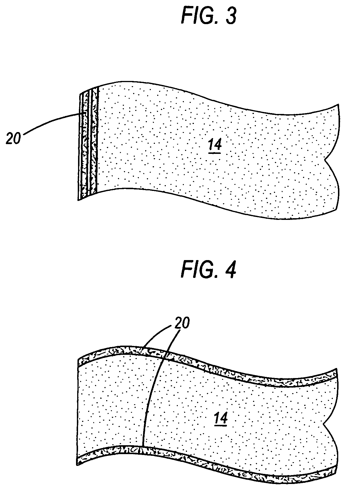 Patent US11779678 Figure 3 – Antimicrobial compression wrap