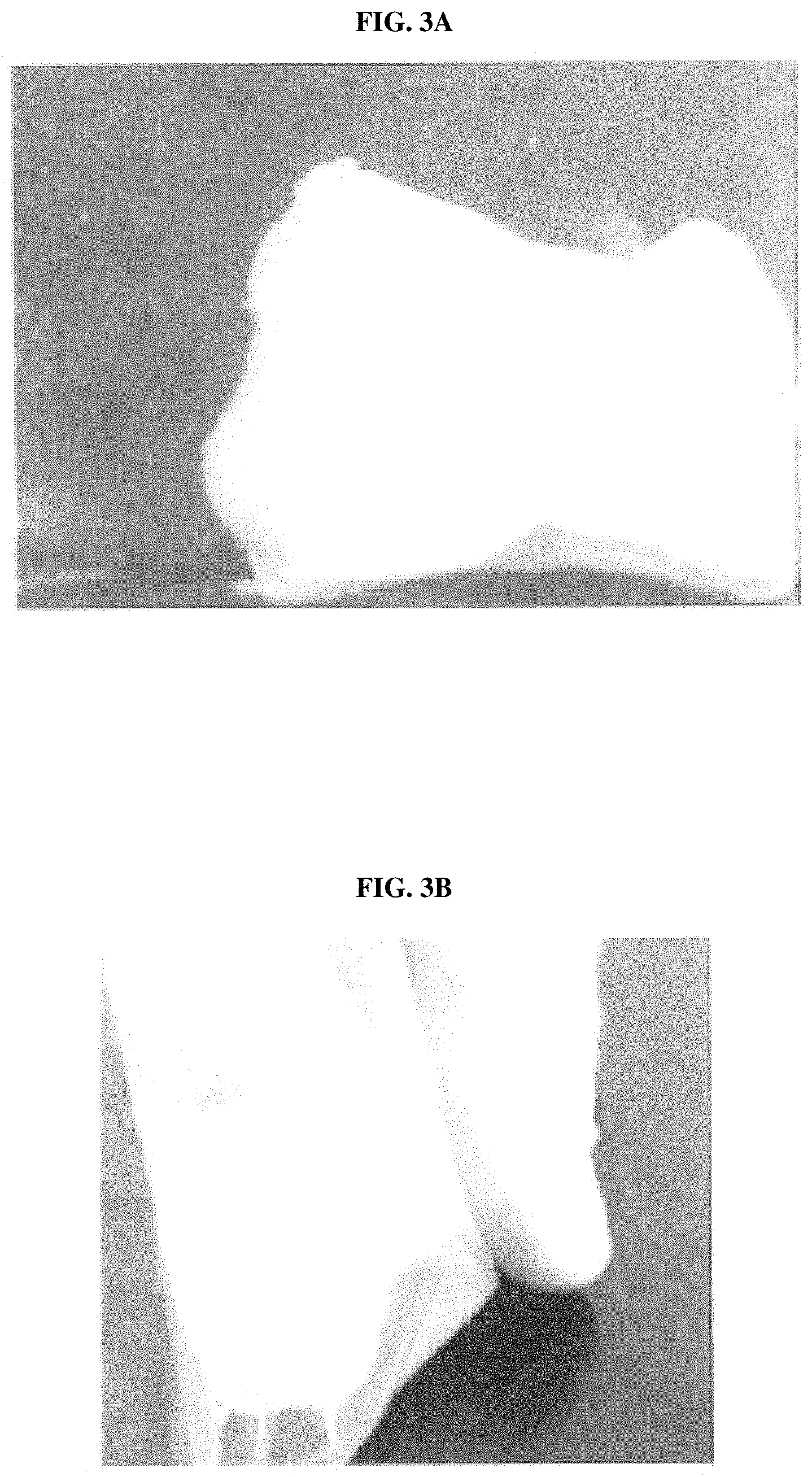 Patent US11779680 Figure 3 – Connective-tissue-based or dermal-tissue-based grafts/implants