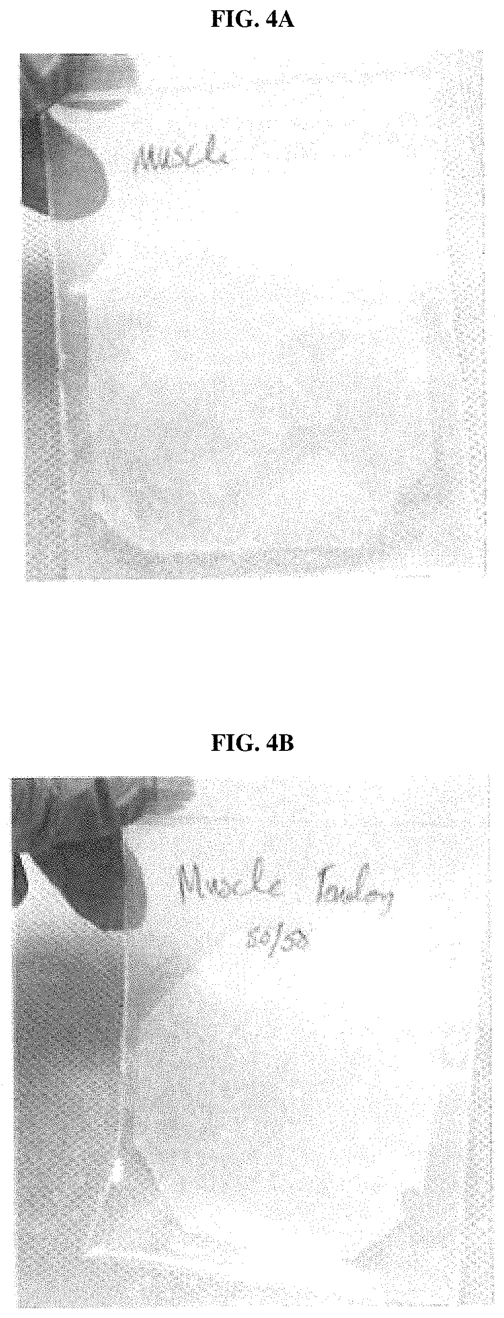 Patent US11779680 Figure 4 – Connective-tissue-based or dermal-tissue-based grafts/implants