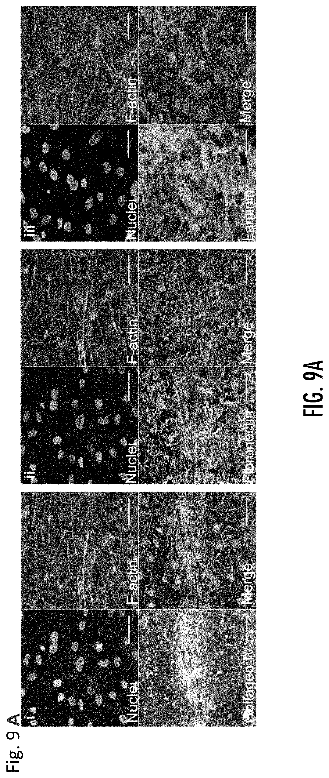 Patent US11779682 Figure 15 – Electro-mechanically stretched micro fibers and methods of use thereof