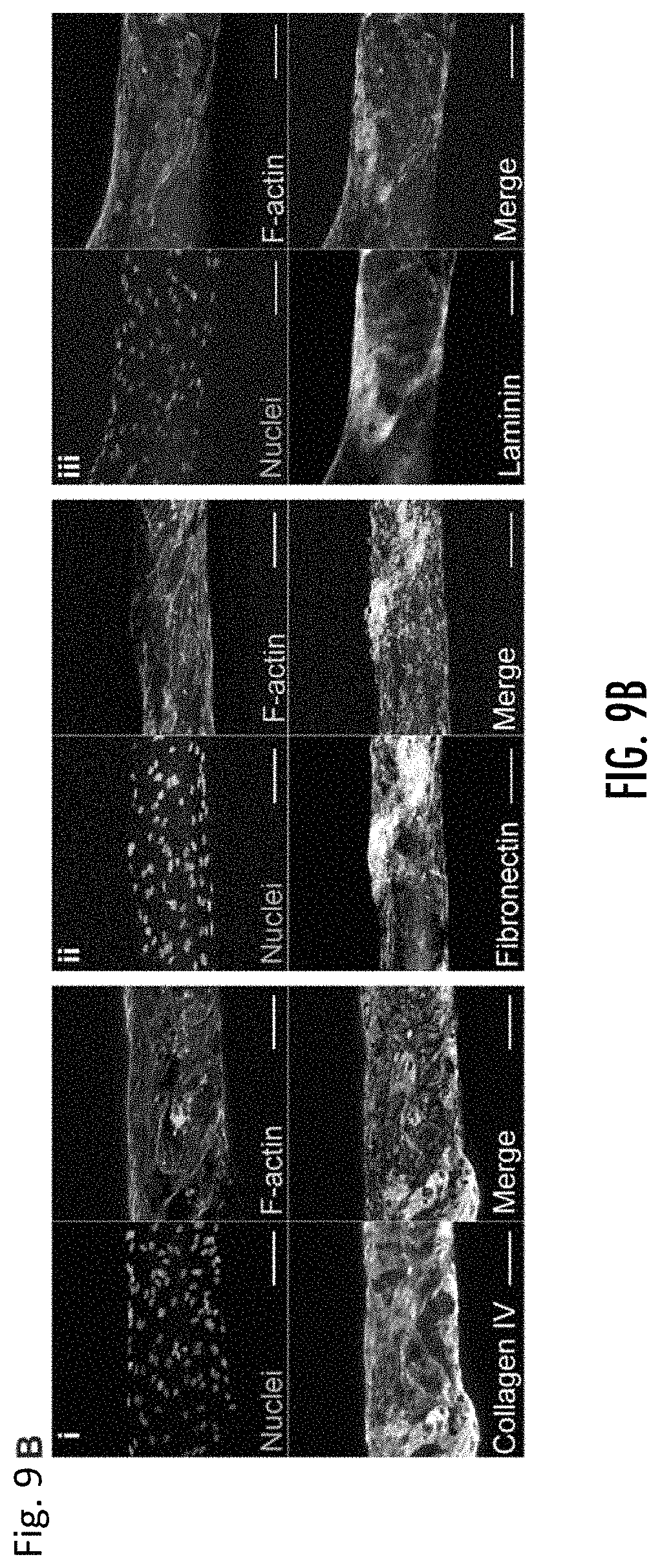 Patent US11779682 Figure 16 – Electro-mechanically stretched micro fibers and methods of use thereof