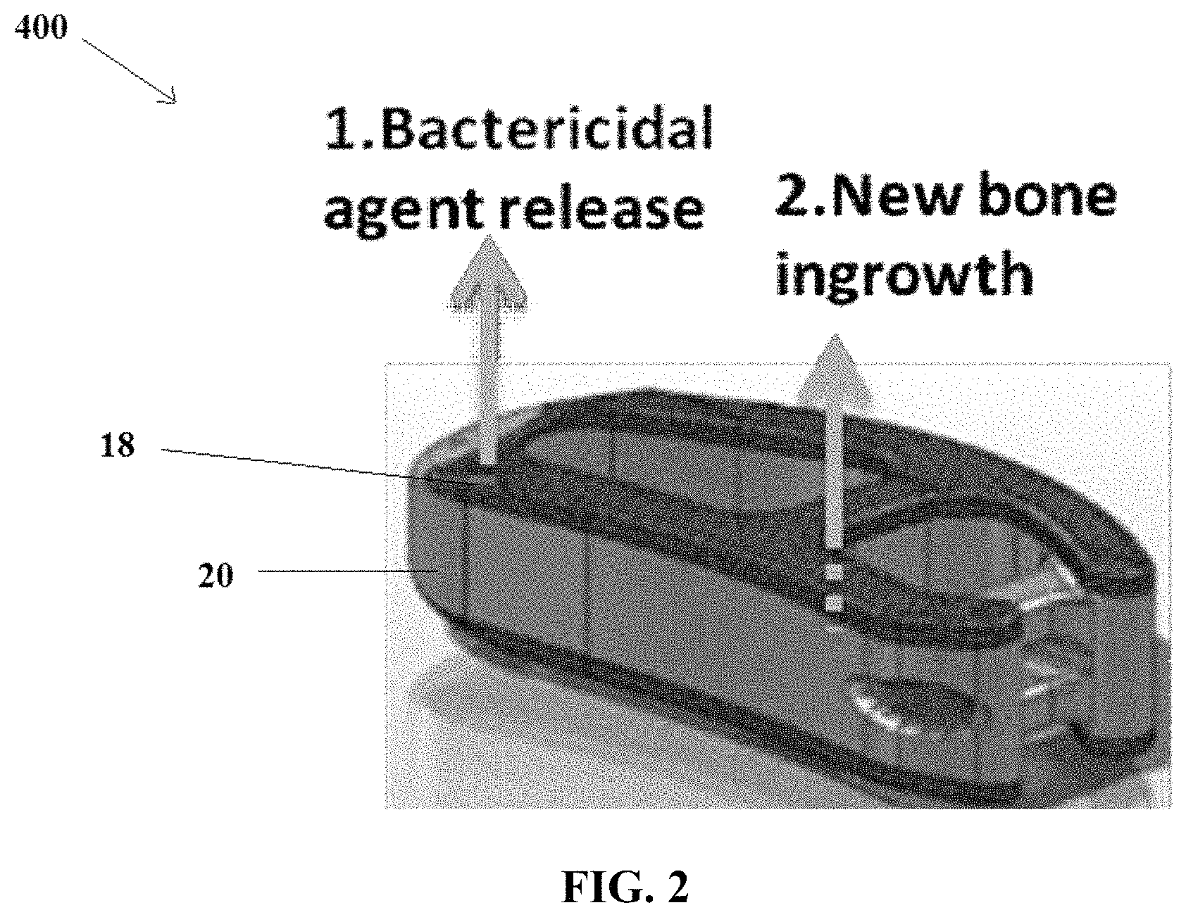 Patent US11779684 Figure 3 – Anti-microbial device and method for its manufacture