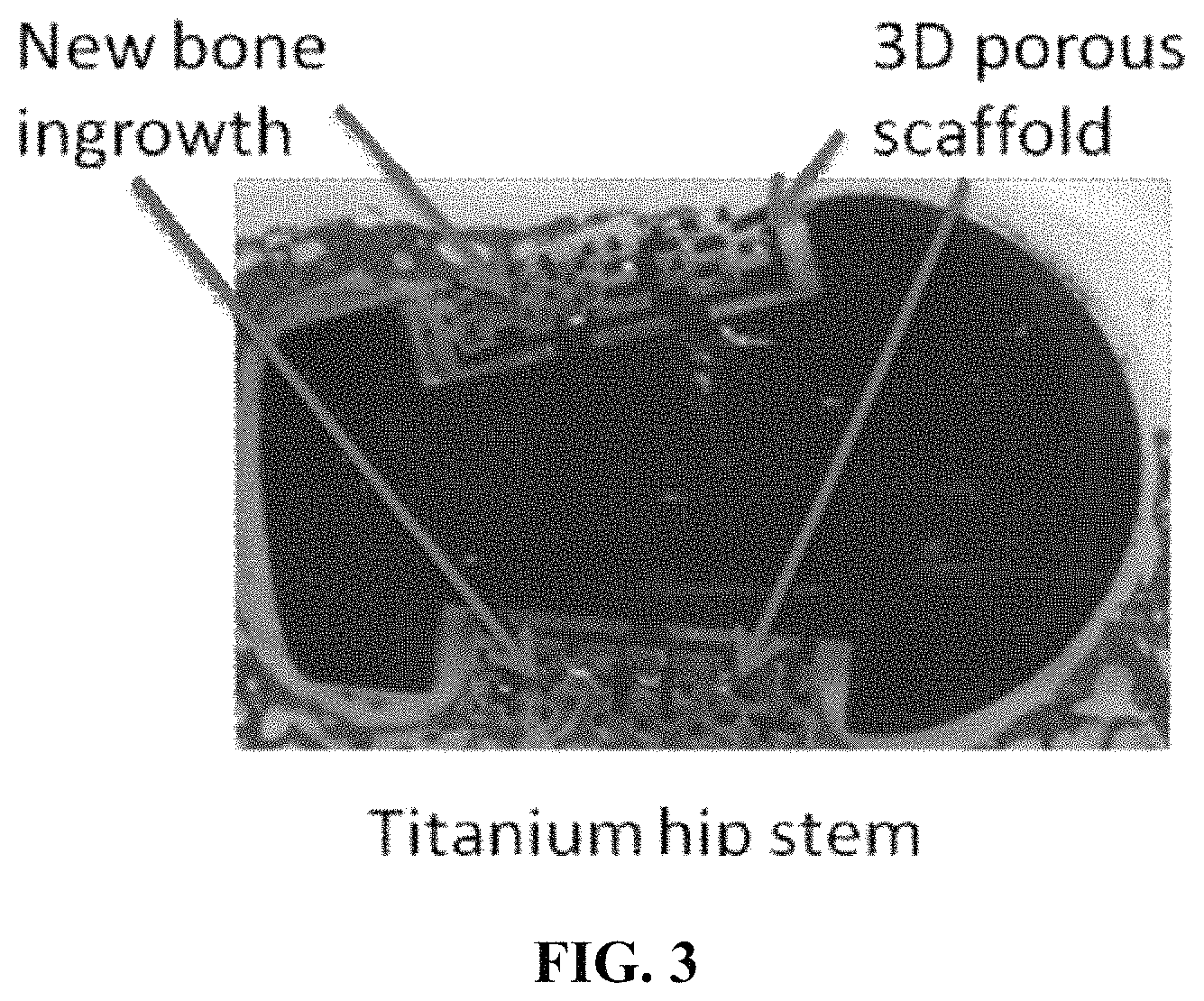 Patent US11779684 Figure 4 – Anti-microbial device and method for its manufacture