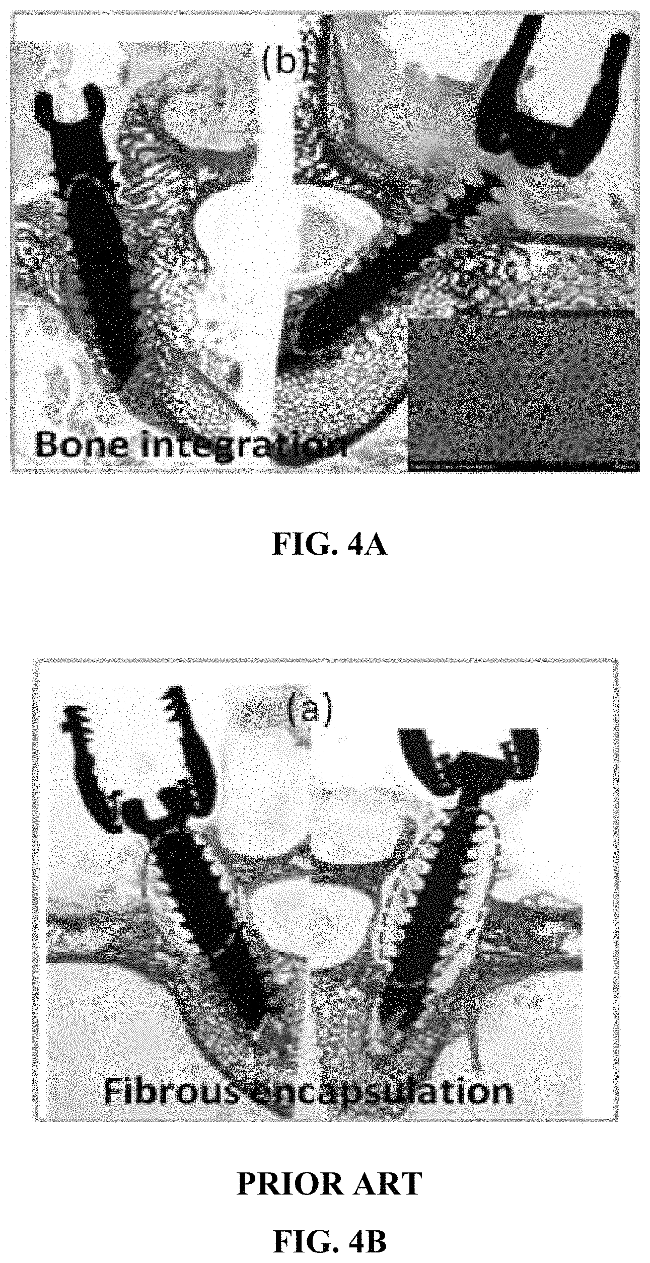 Patent US11779684 Figure 5 – Anti-microbial device and method for its manufacture