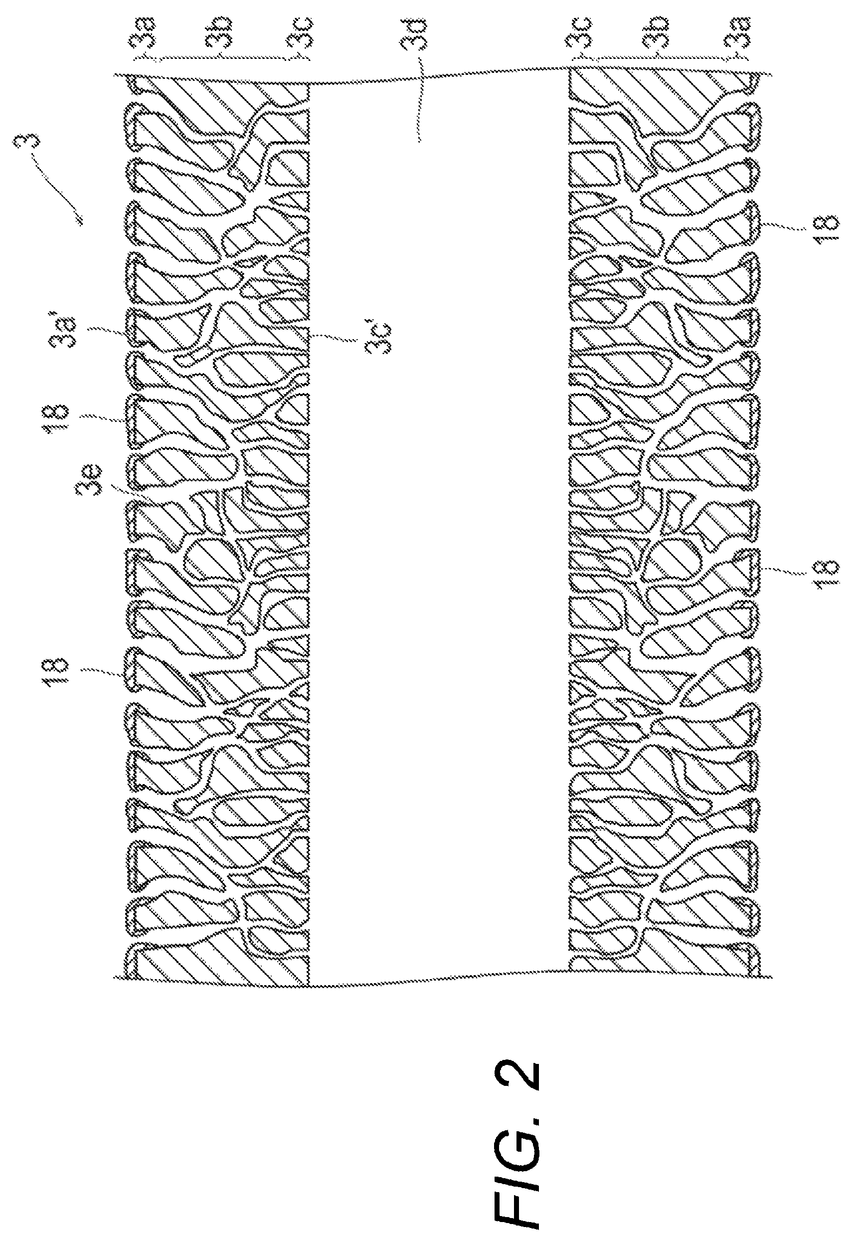 Patent US11779690 Figure 2 – Oxygenator antithrombotic coating and method of manufacture