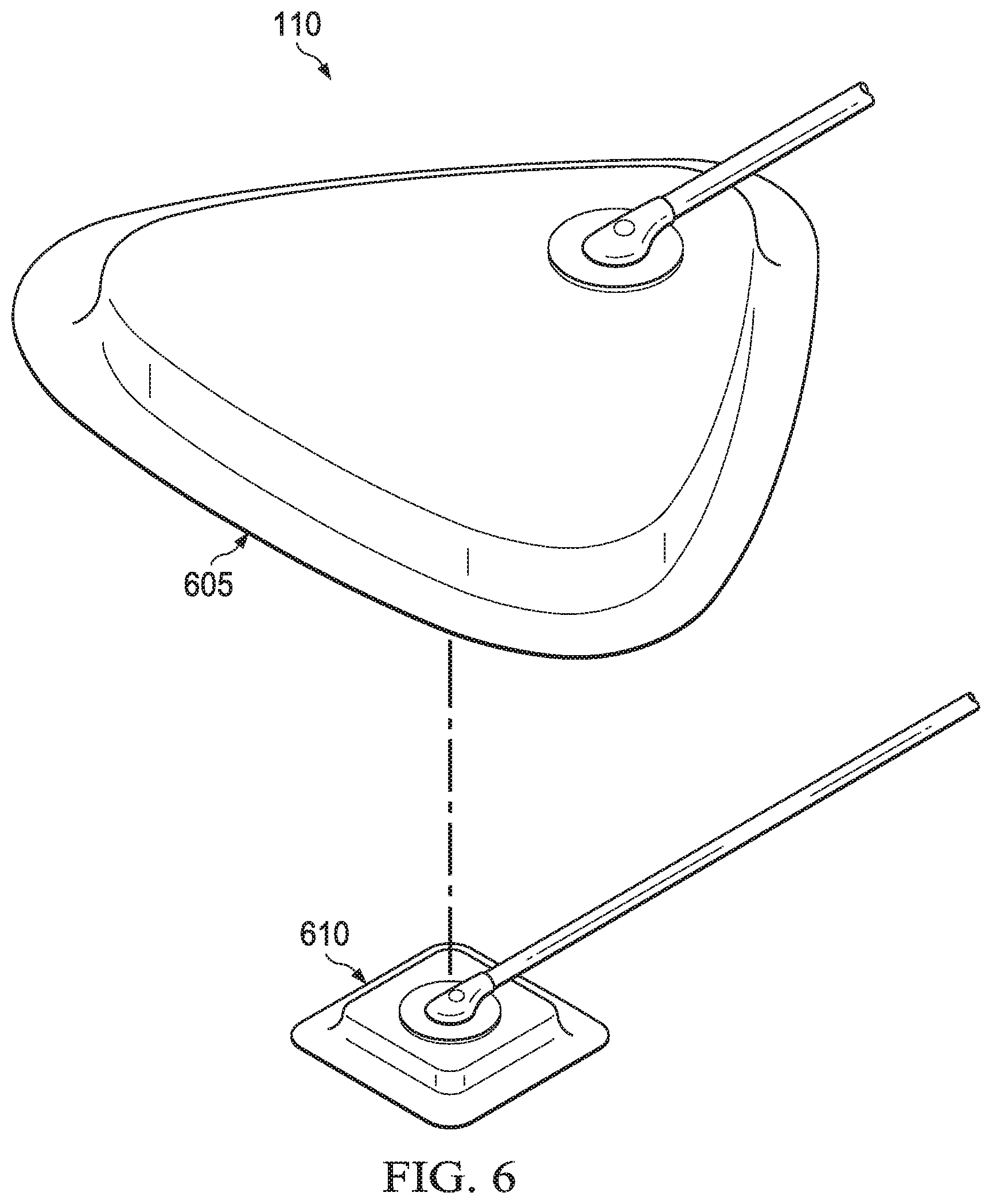 Patent US11779693 Figure 5 – Negative-pressure wound therapy dressing with zone of ambient pressure