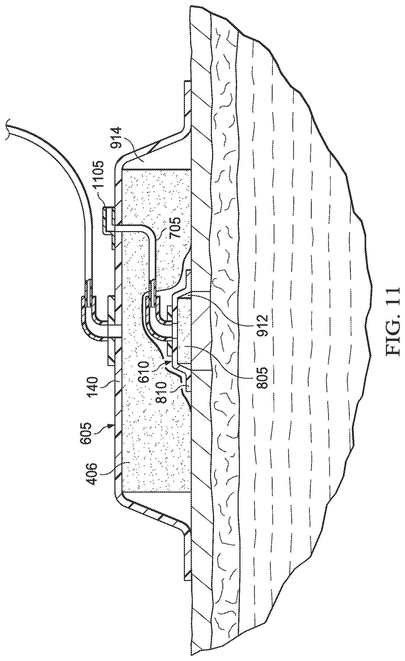 Patent US11779693 Figure 9 – Negative-pressure wound therapy dressing with zone of ambient pressure