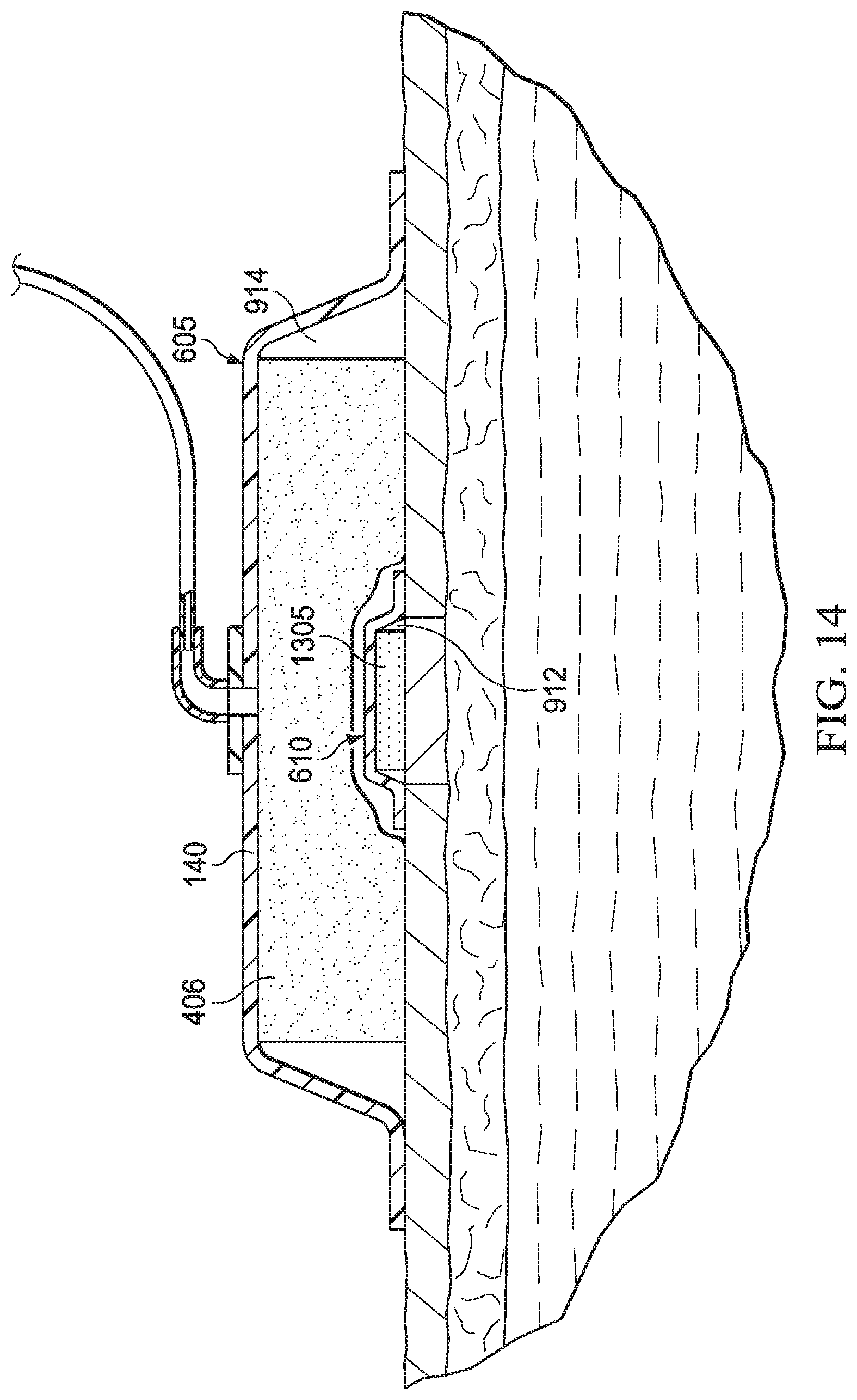 Patent US11779693 Figure 12 – Negative-pressure wound therapy dressing with zone of ambient pressure