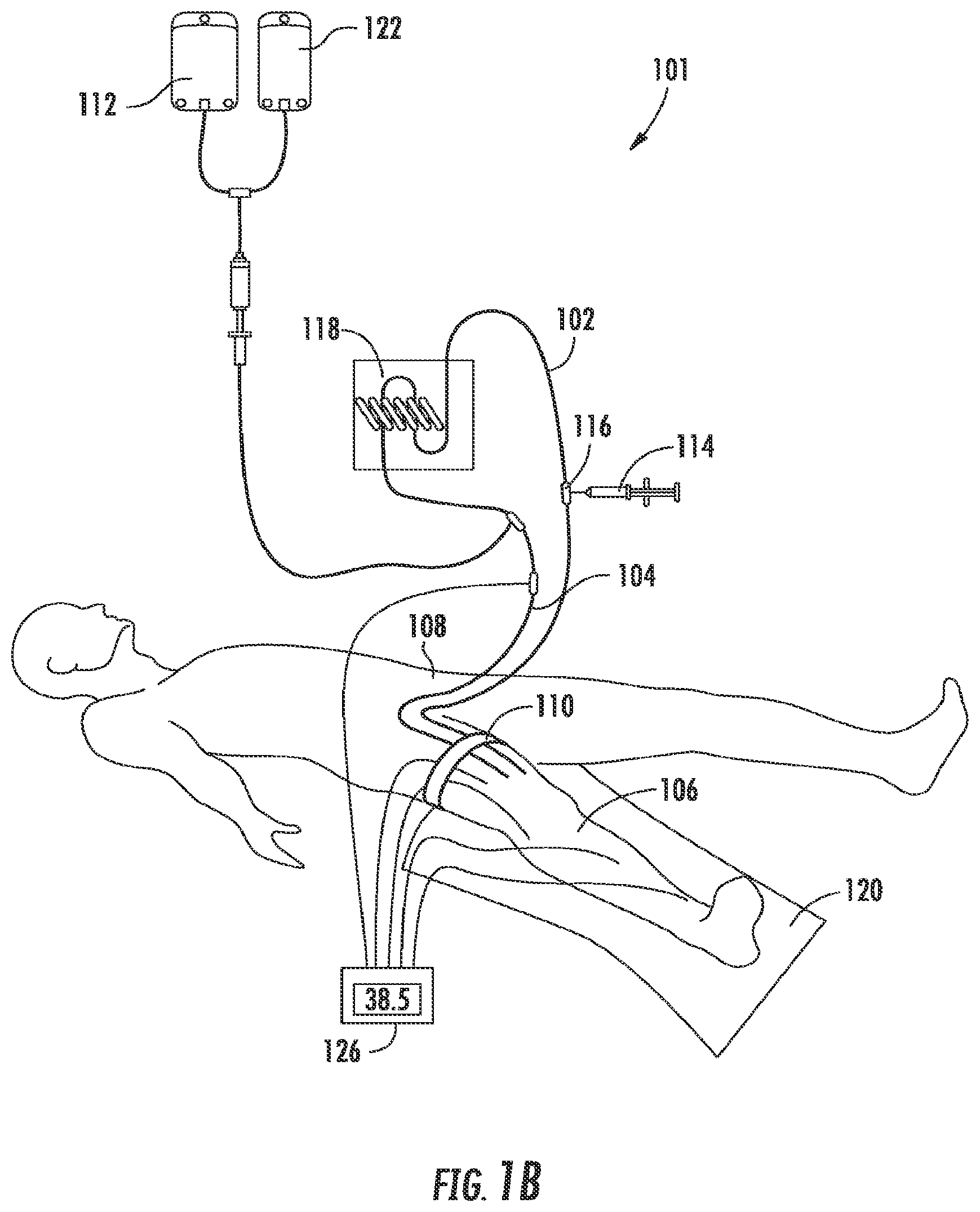 Patent US11779698 Figure 2 – High flow rate isolated infusion for regional treatment of cancer and medical conditions