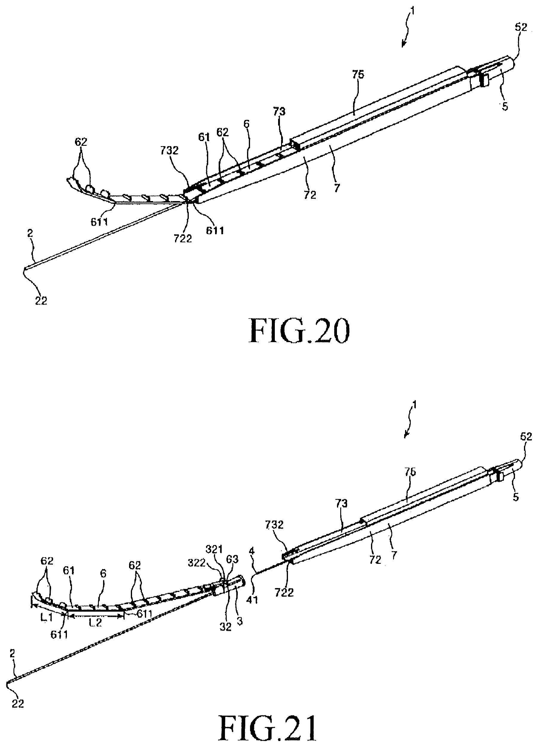 Patent US11779700 Figure 13 – Indwelling assembly