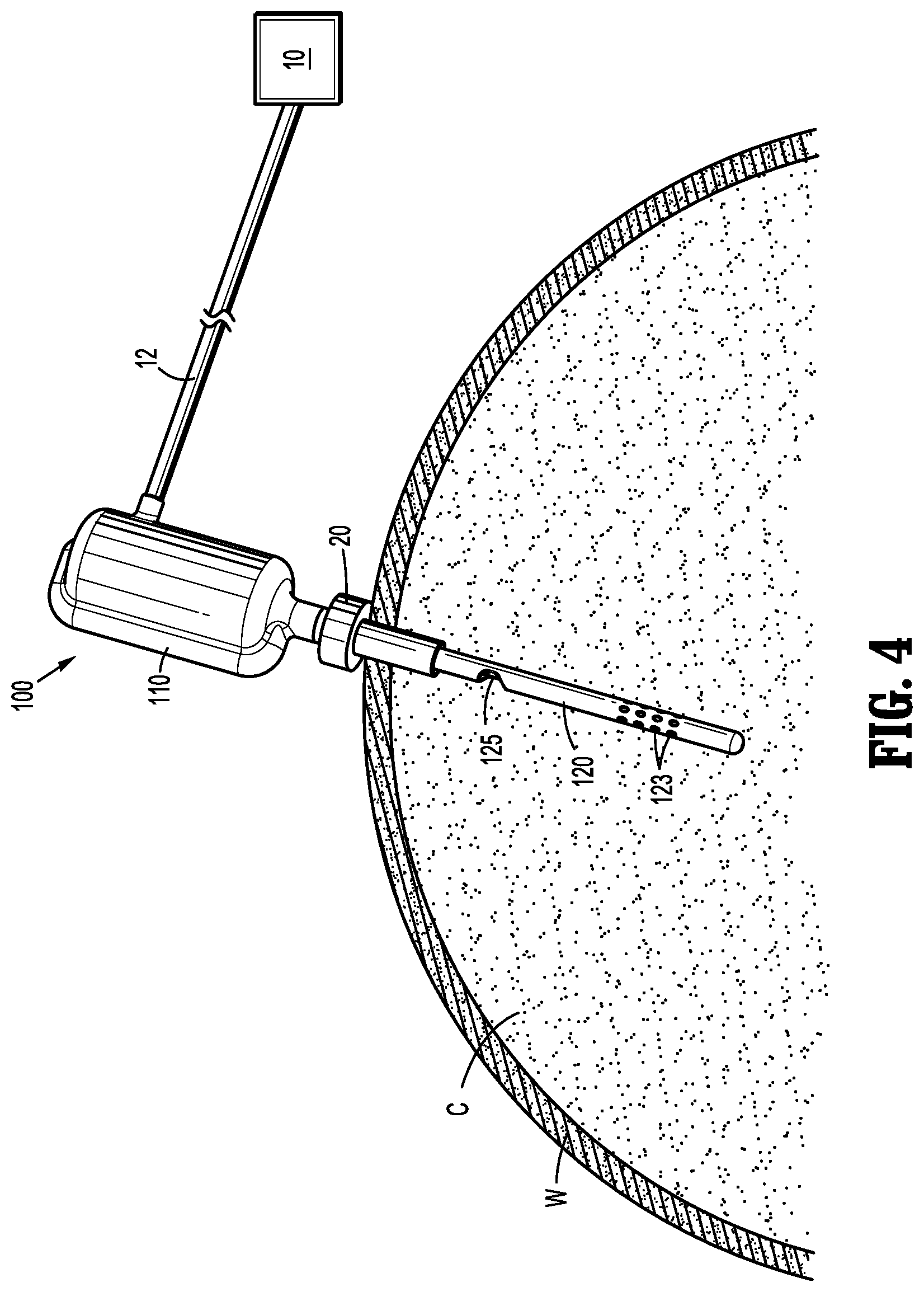 Patent US11779713 Figure 4 – Air purifier for laparoscopic surgery