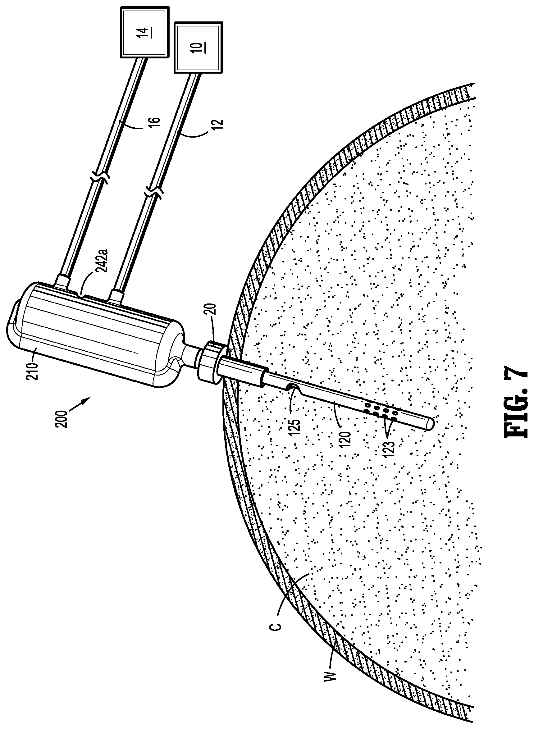 Patent US11779713 Figure 7 – Air purifier for laparoscopic surgery