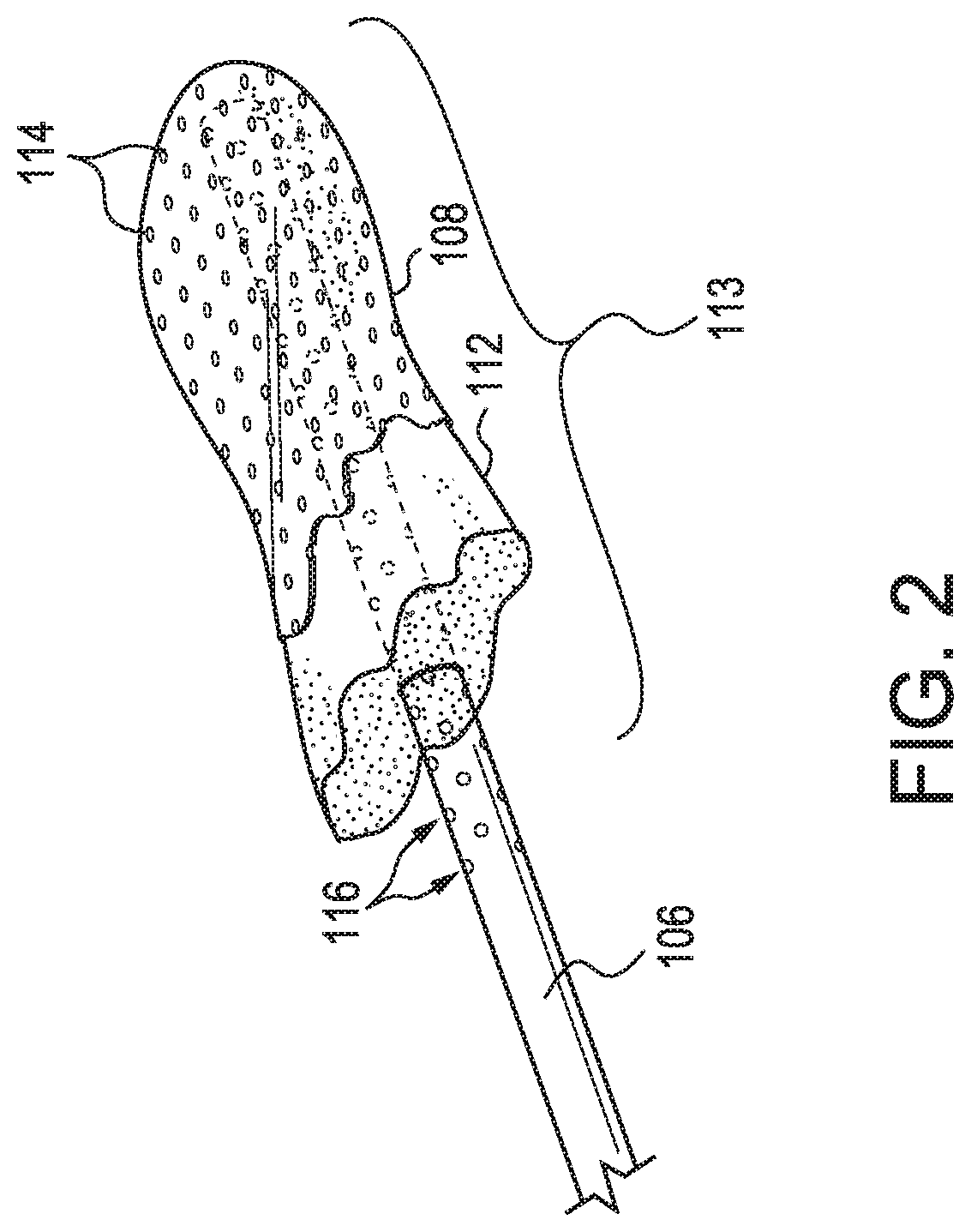 Patent US11779721 Figure 2 – Oral suction device