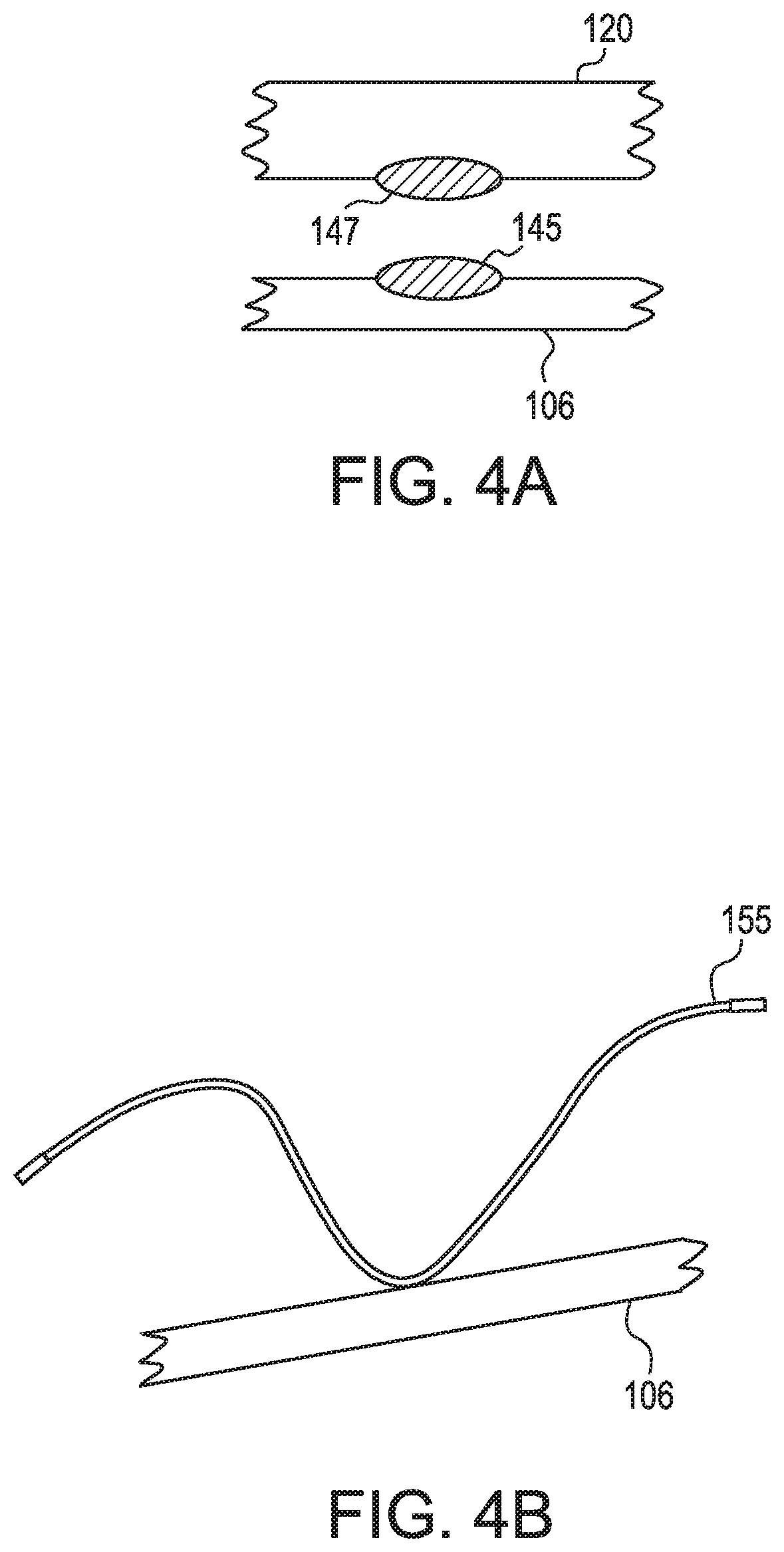 Patent US11779721 Figure 4 – Oral suction device