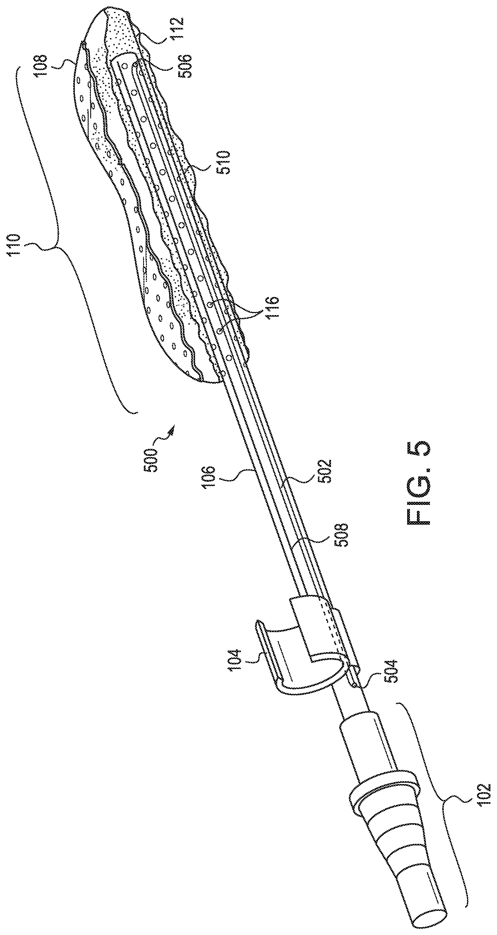 Patent US11779721 Figure 5 – Oral suction device