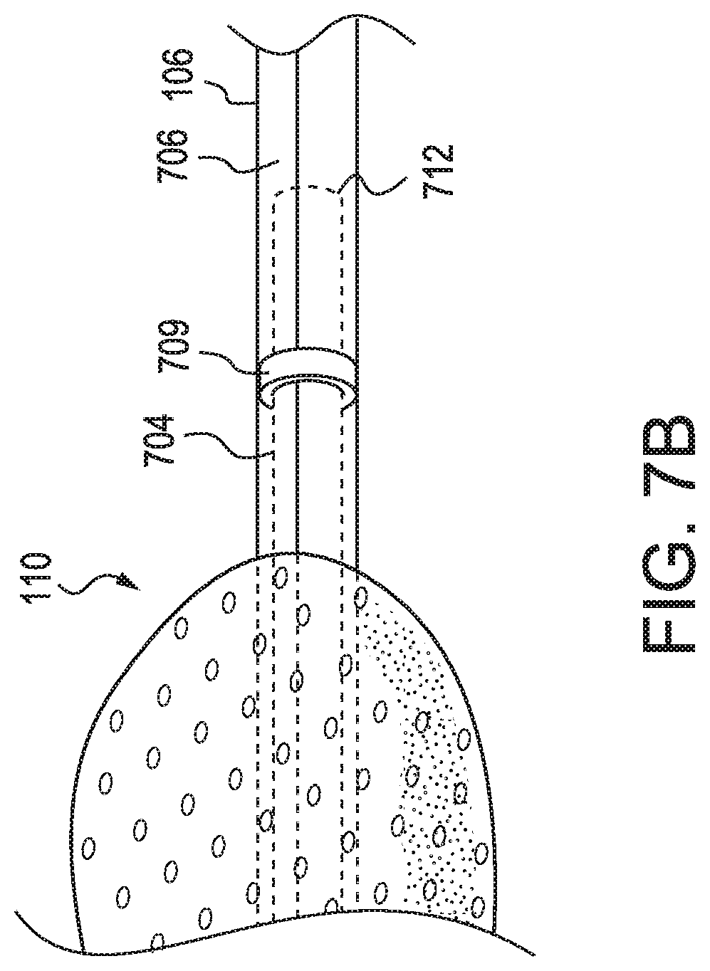 Patent US11779721 Figure 8 – Oral suction device