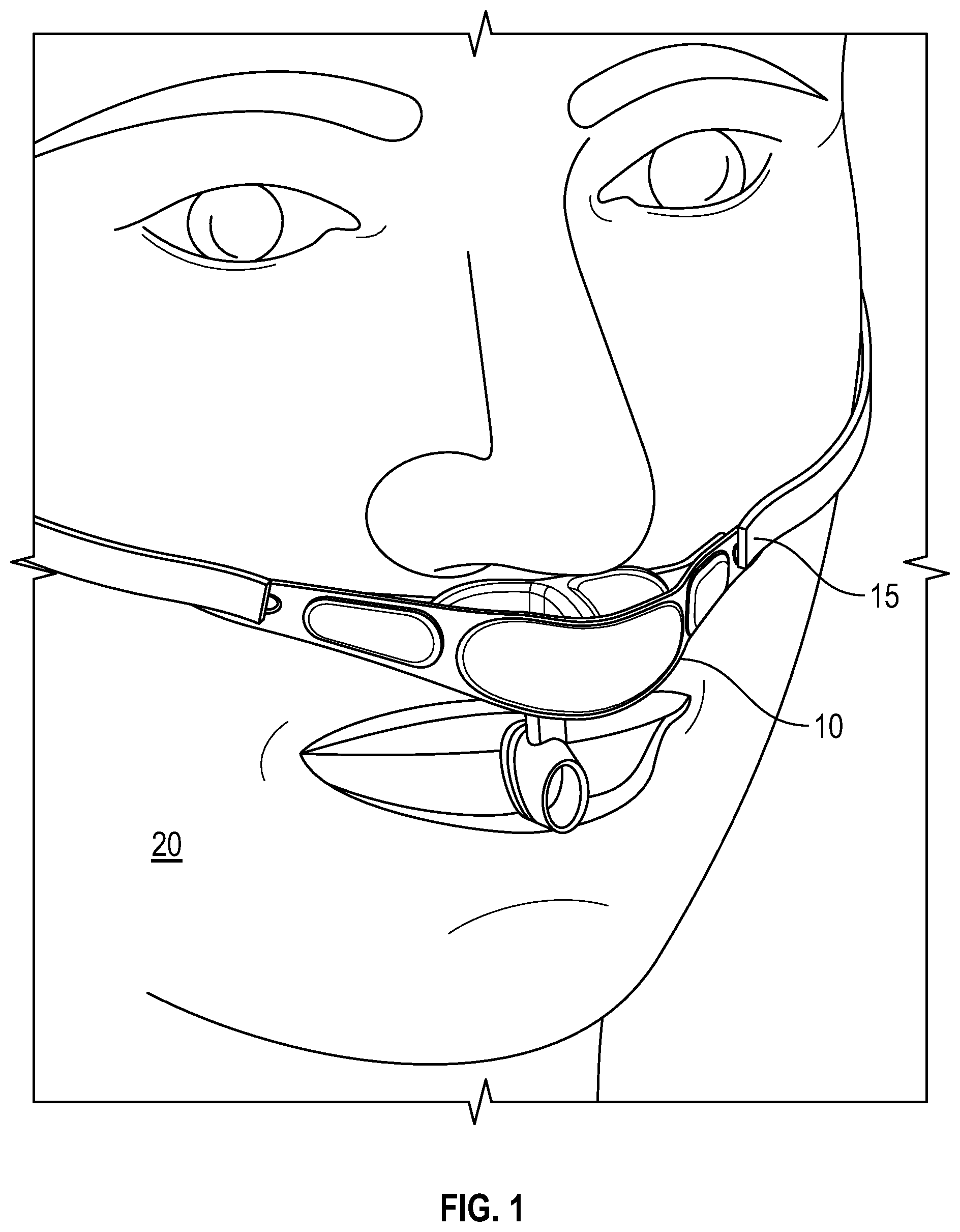 Patent US11779724 Figure 1 – Respiration sensor attachment device