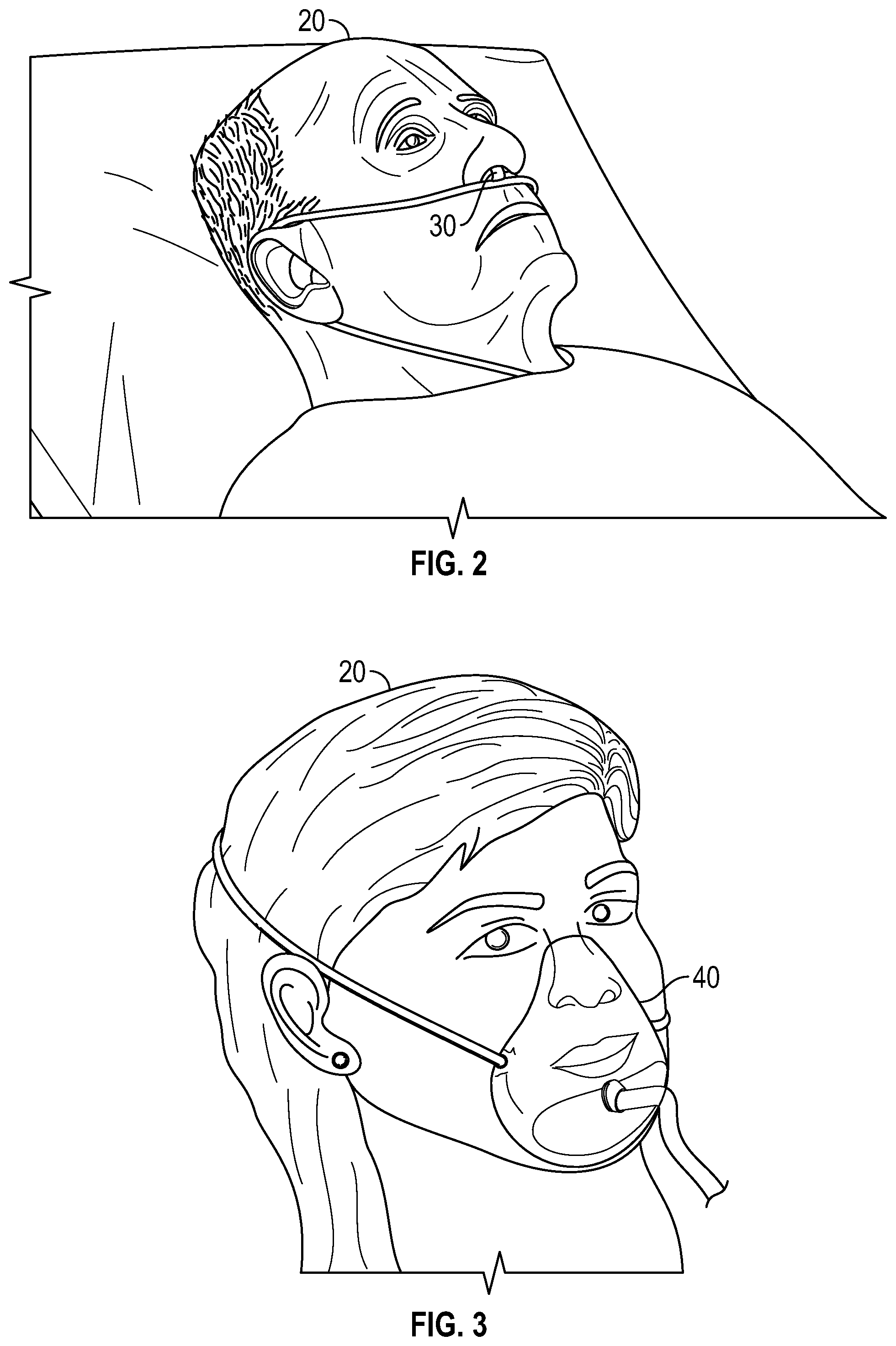 Patent US11779724 Figure 2 – Respiration sensor attachment device