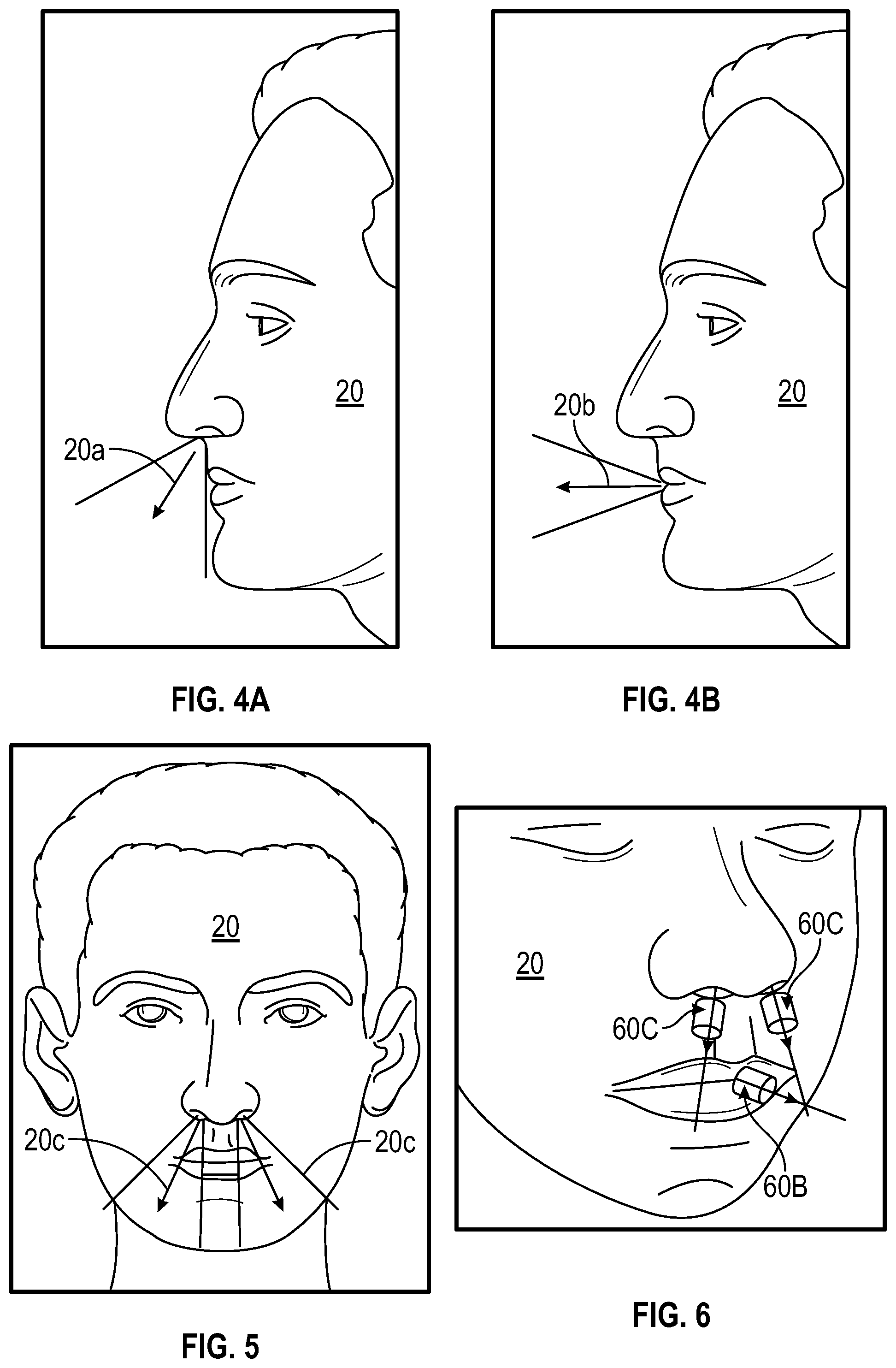 Patent US11779724 Figure 3 – Respiration sensor attachment device