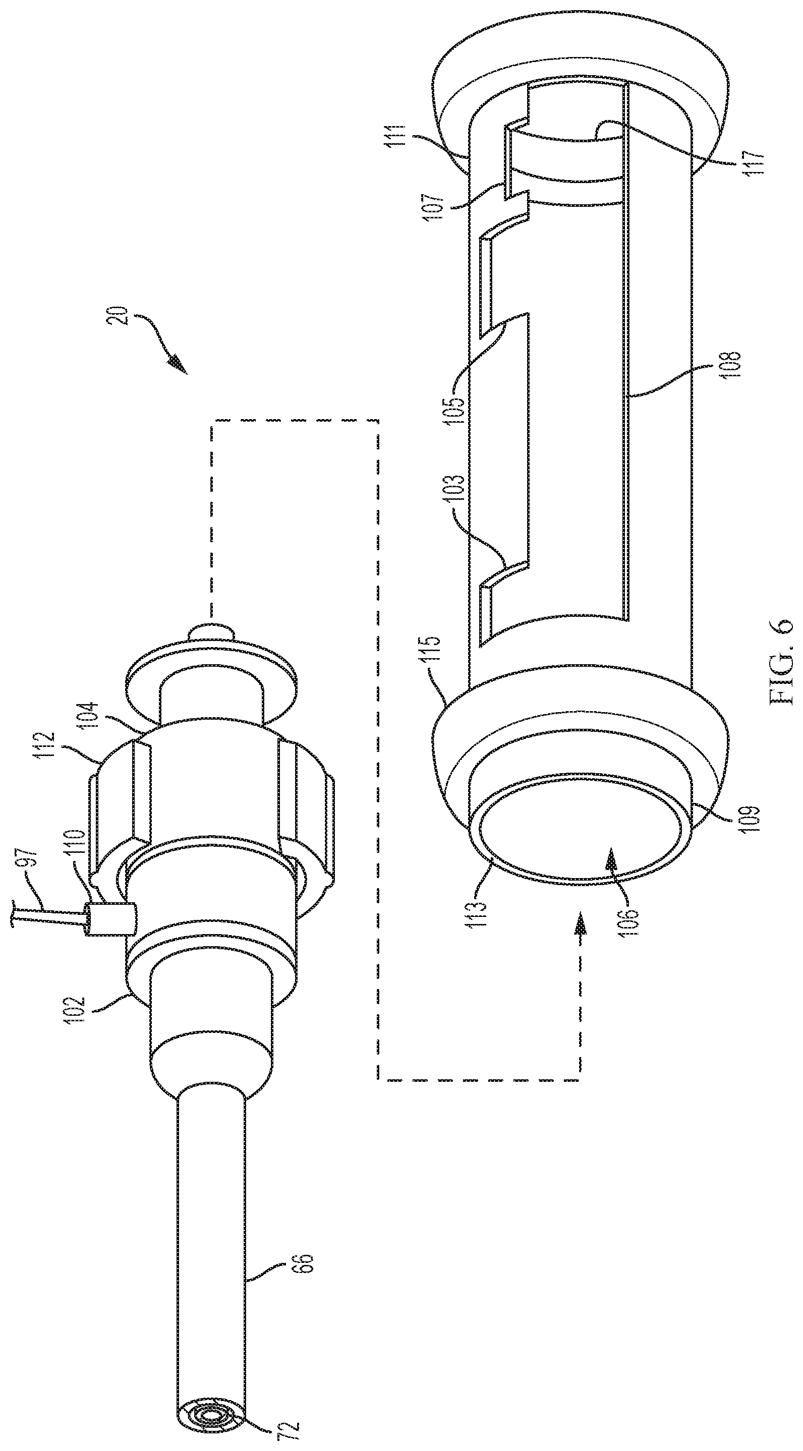Patent US11779728 Figure 4 – Introducer sheath with expandable introducer