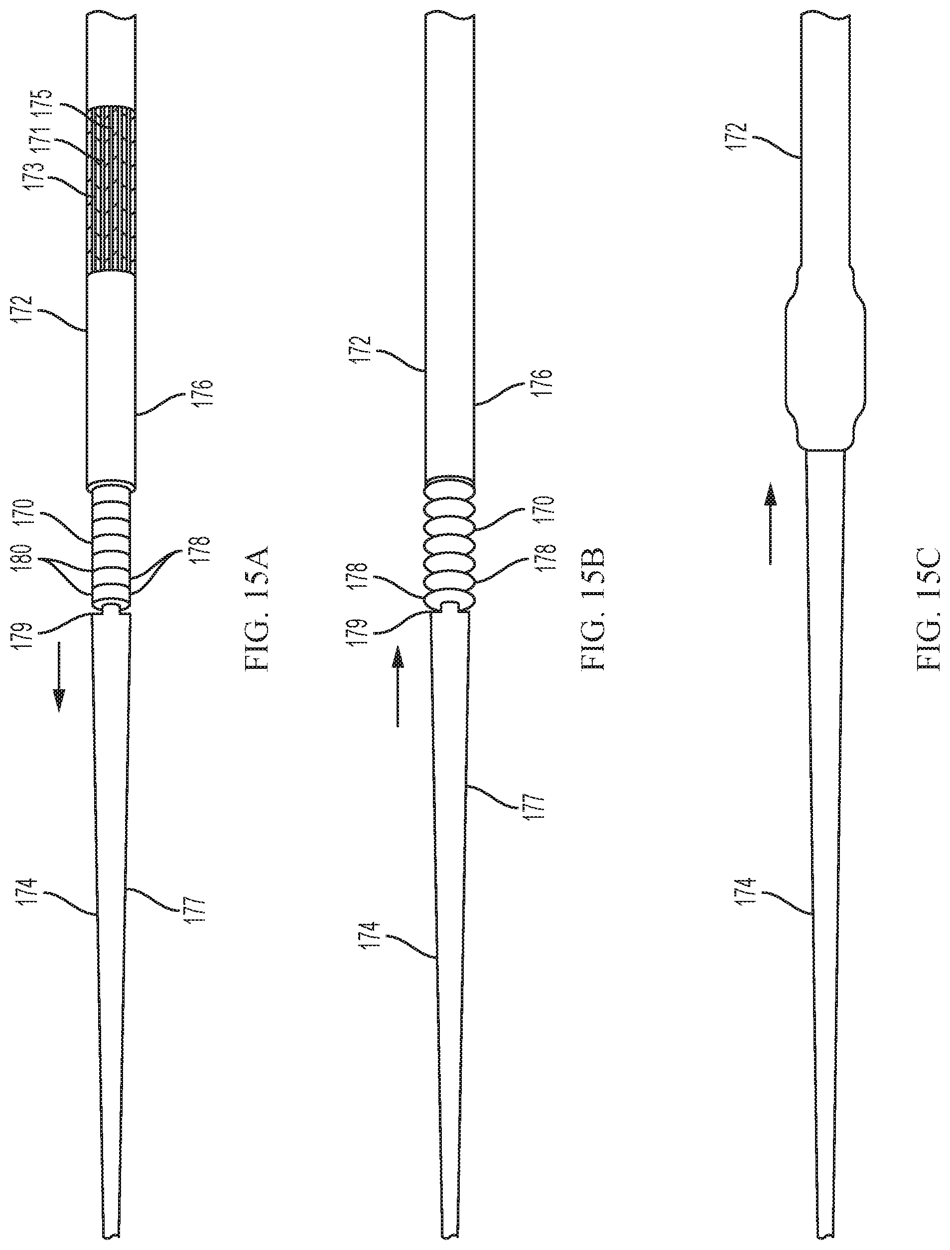 Patent US11779728 Figure 13 – Introducer sheath with expandable introducer